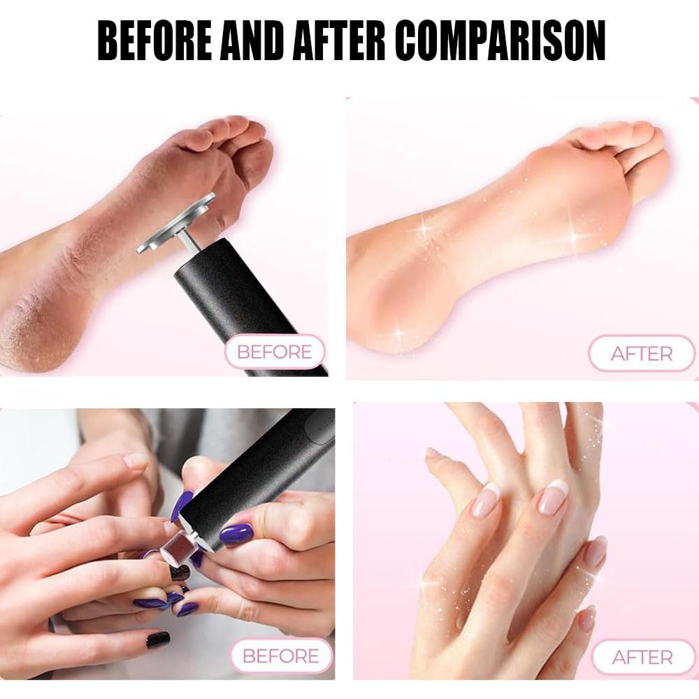 Removedor de Callos Eléctrico Inalámbrico Dr.Pedi 2 en 1