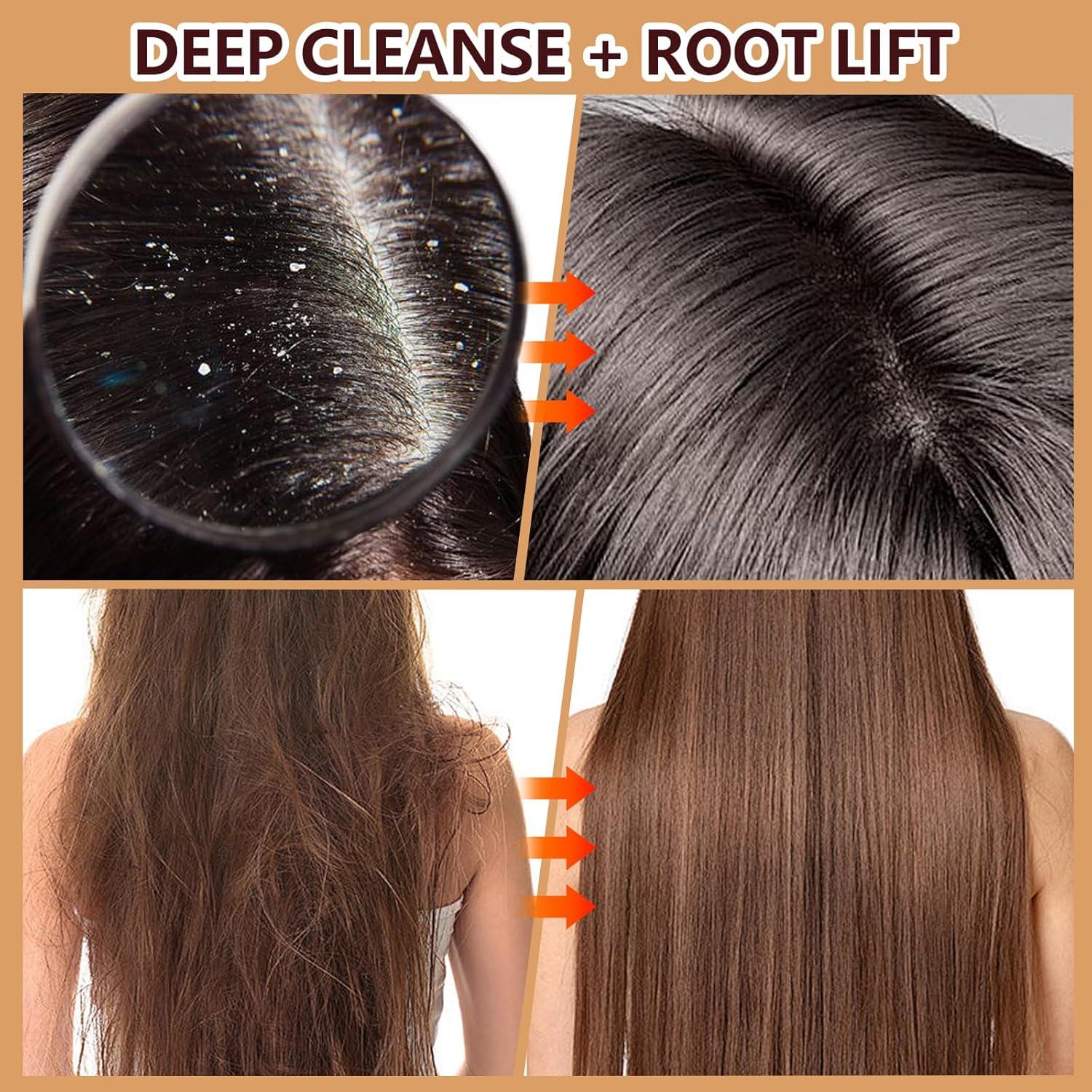 Exfoliante de cuero cabelludo GUOYAOLIFU 300g 2 en 1 con masajeador