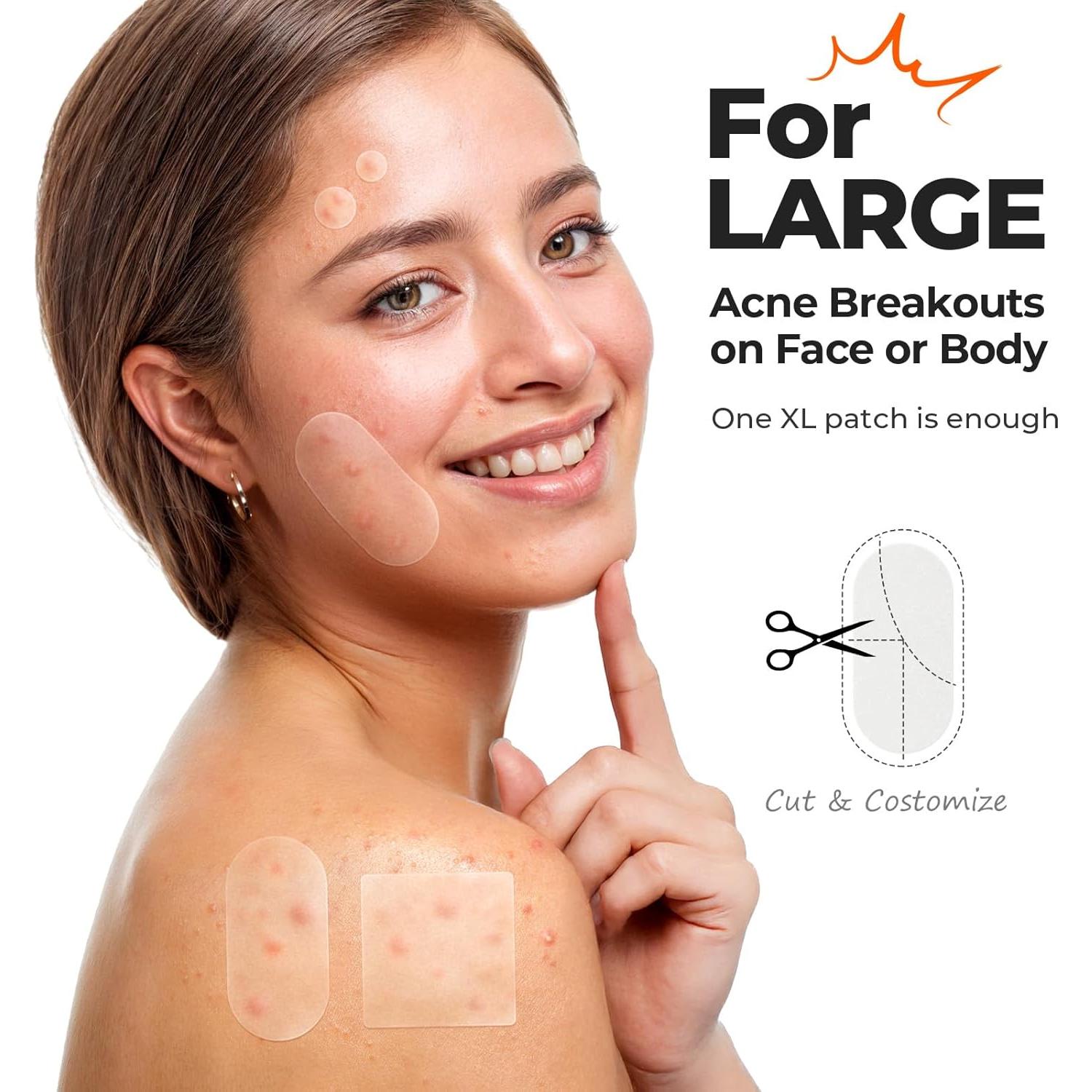 Parche Hidrocoloide XL TKTK para Acné - 124 Parches 60x30mm