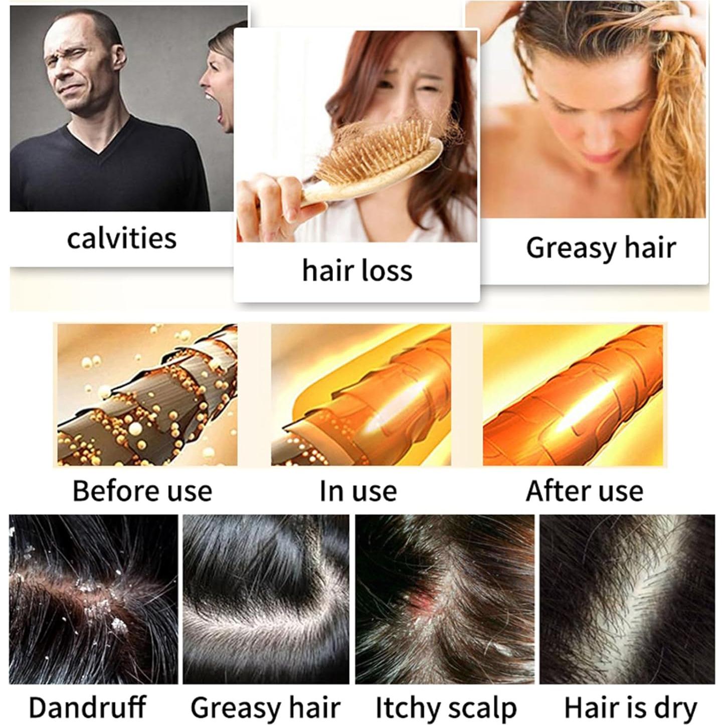 Champú Sólido Natural Hotiary para Oscurecer Cabello Gris - 2 Unidades