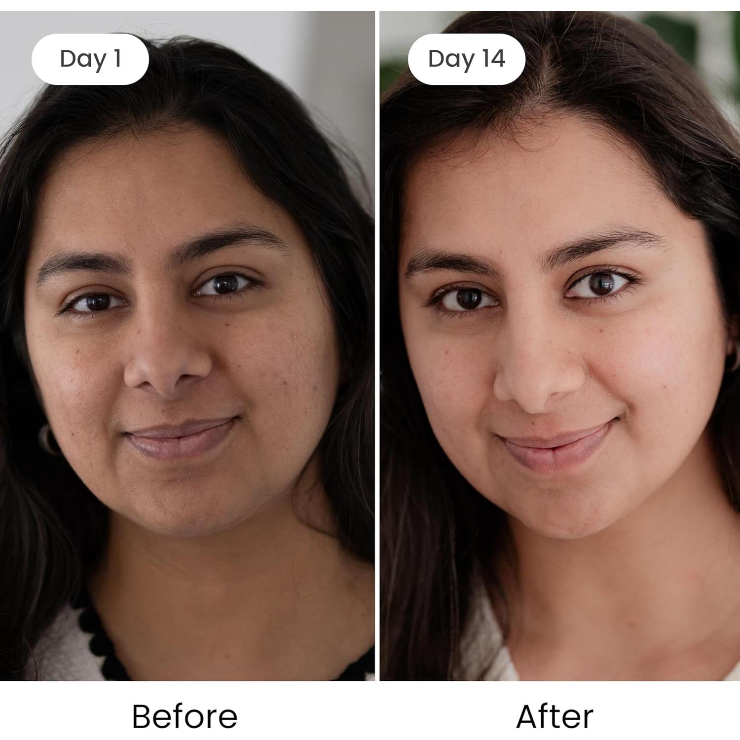 Aceite Kumkumadi Shankara 18ml con Azafrán y Hierbas Ayurvédicas