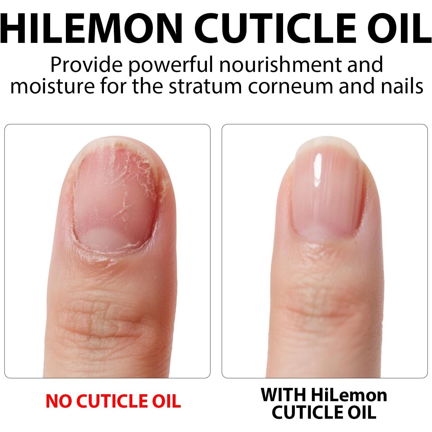 Aceite Natural para Cutículas HiLemon 1.48 ml x 5 - Hidratante