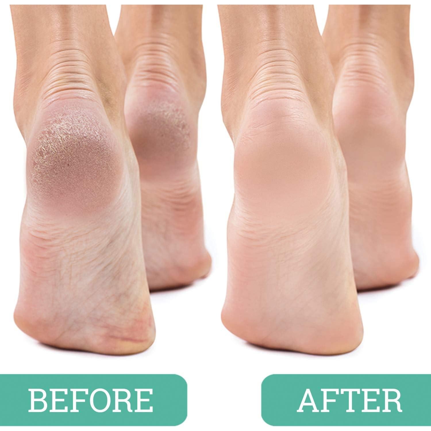 Piedra Pómez Exfoliadora para Pies Maccibelle 12.7x5.1cm