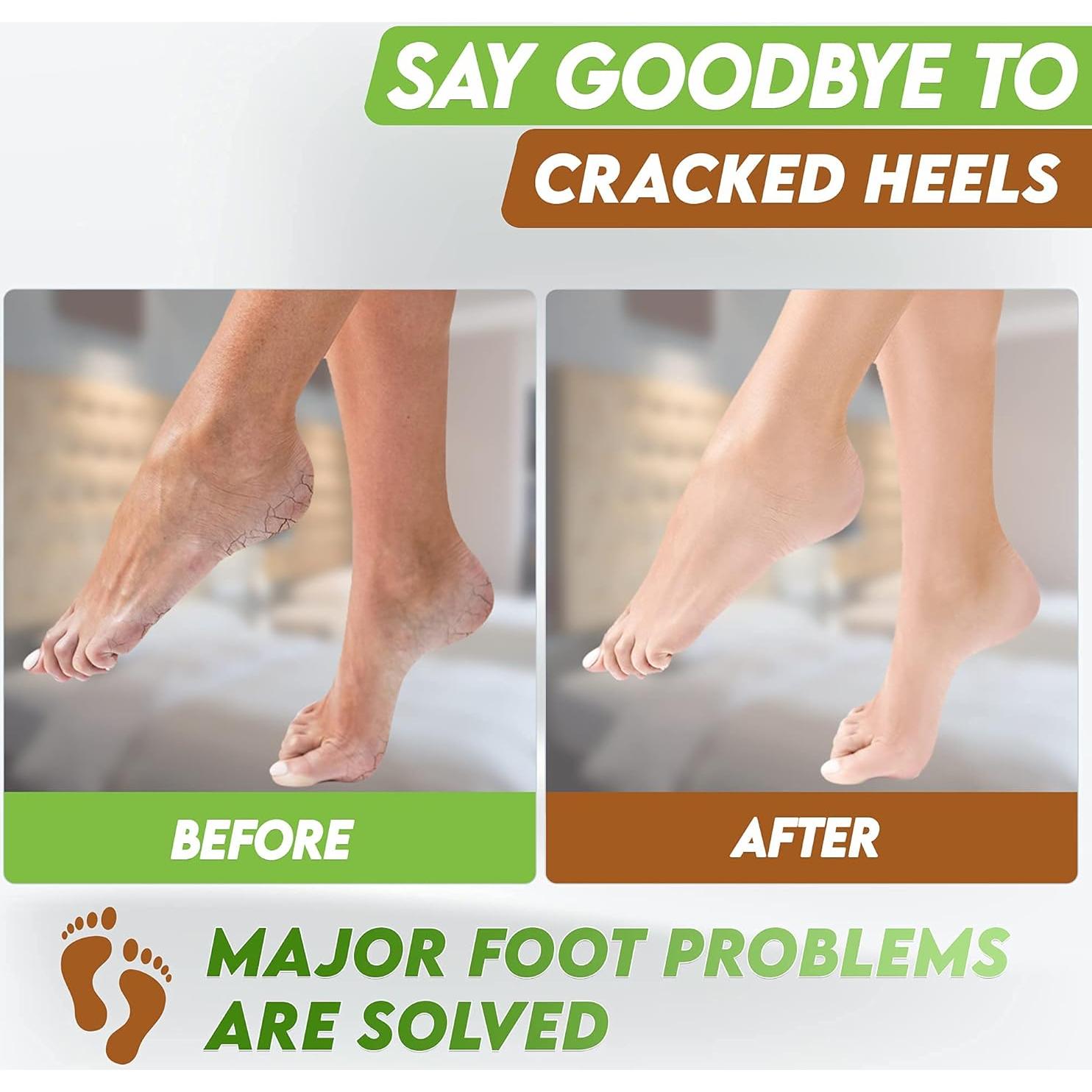 Máscaras Exfoliantes para Pies Karma Organic - Hidratación y Reparación