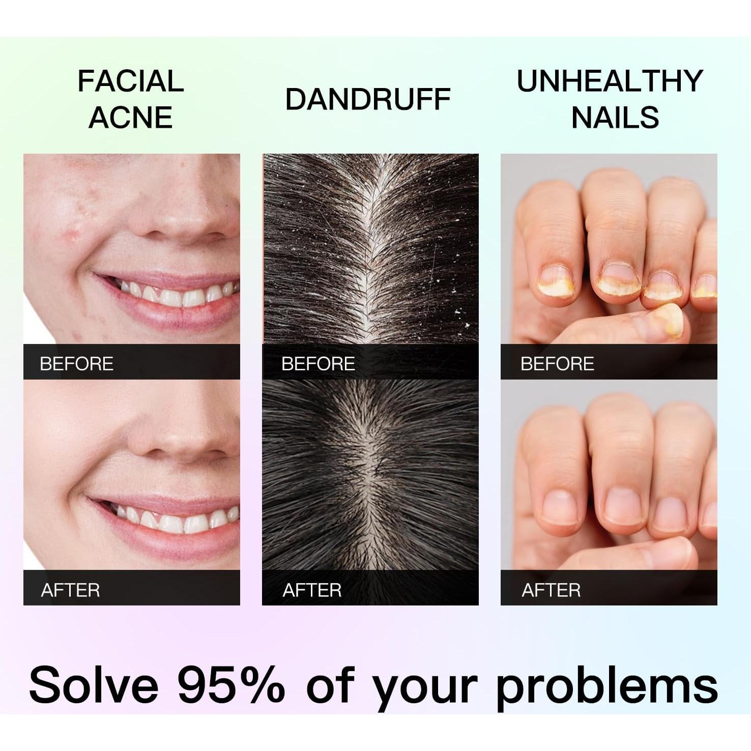 Aceite Esencial de Árbol de Té QONG 10ml - Puro y Natural