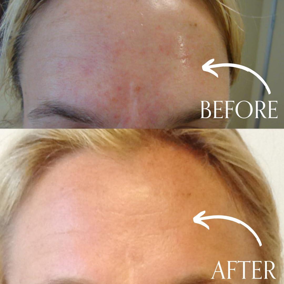 Almohadillas Exfoliantes Antienvejecimiento Radical Skincare - 60 Unidades