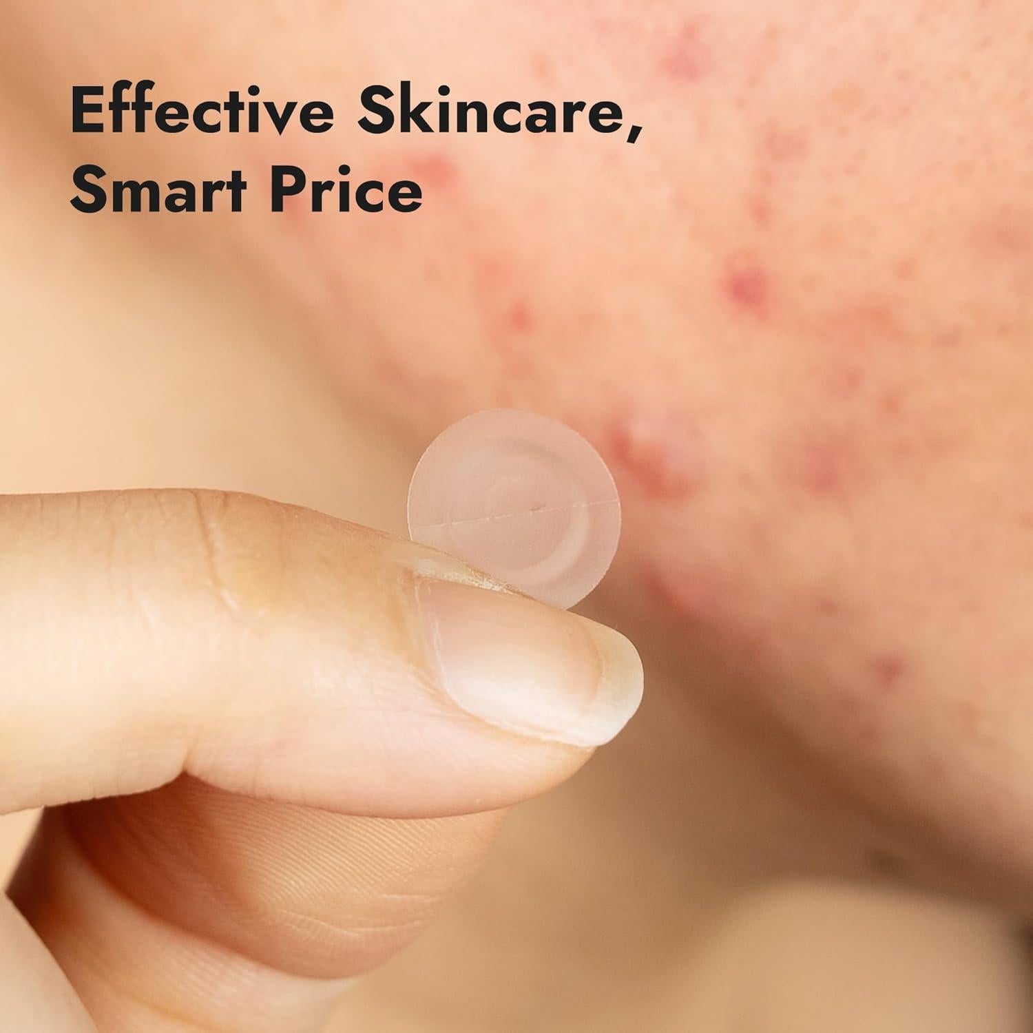 Parche Hidrocoloide para Acné Epielle Over-Zit 138 Unidades