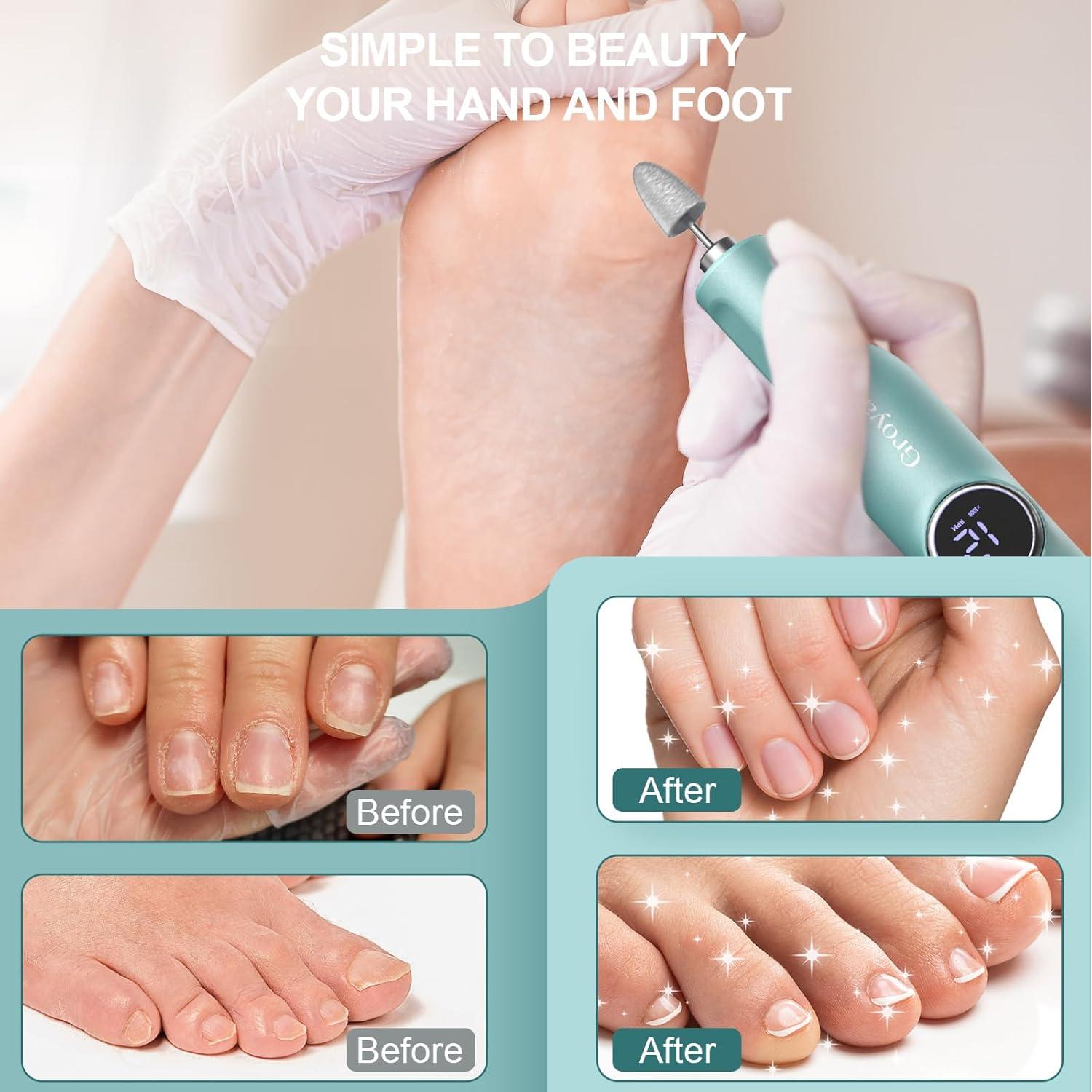 Removedor de Callos Eléctrico Groyal M306 Inalámbrico Verde