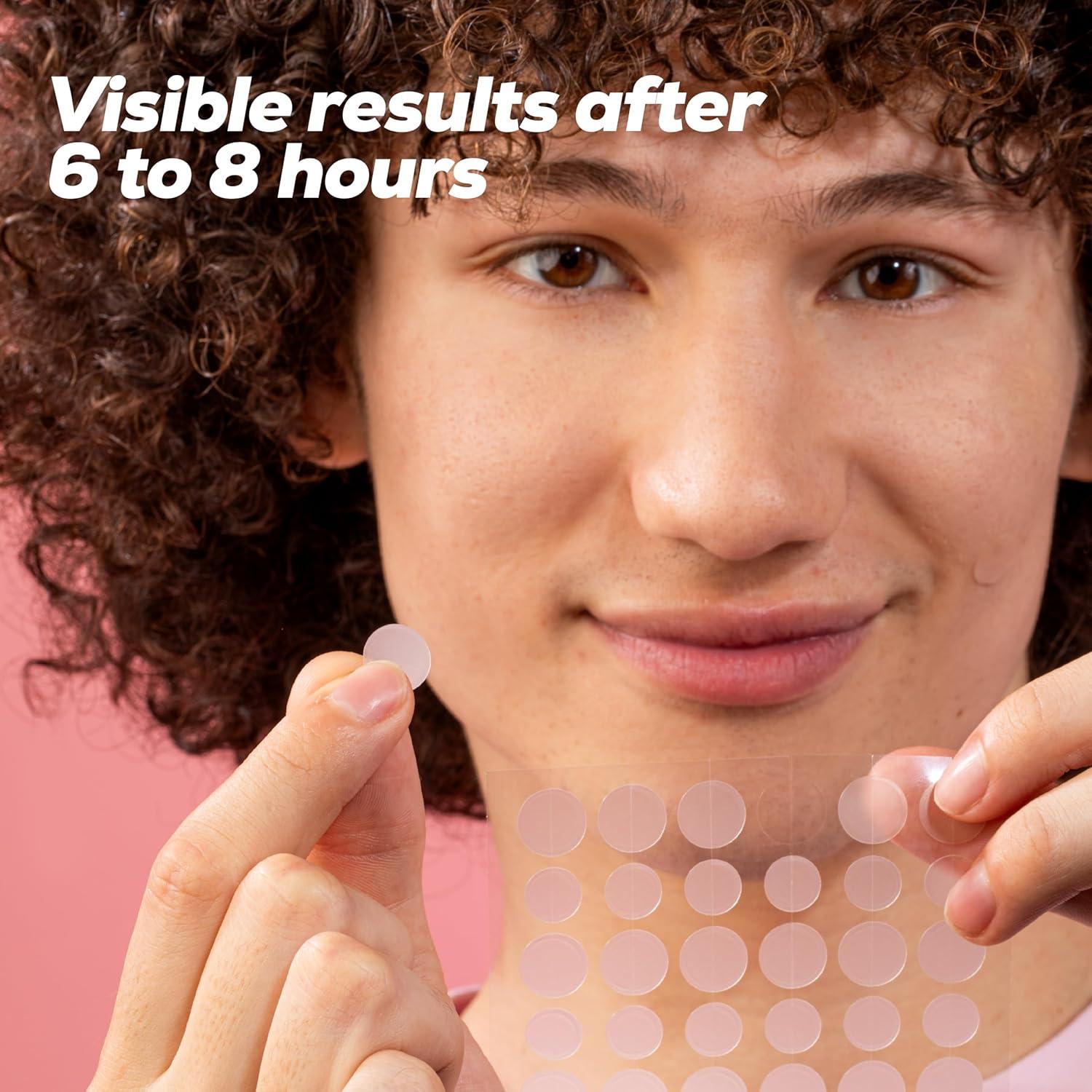 Parches Hidrocoloides para Imperfecciones Hanhoo 288 Unidades