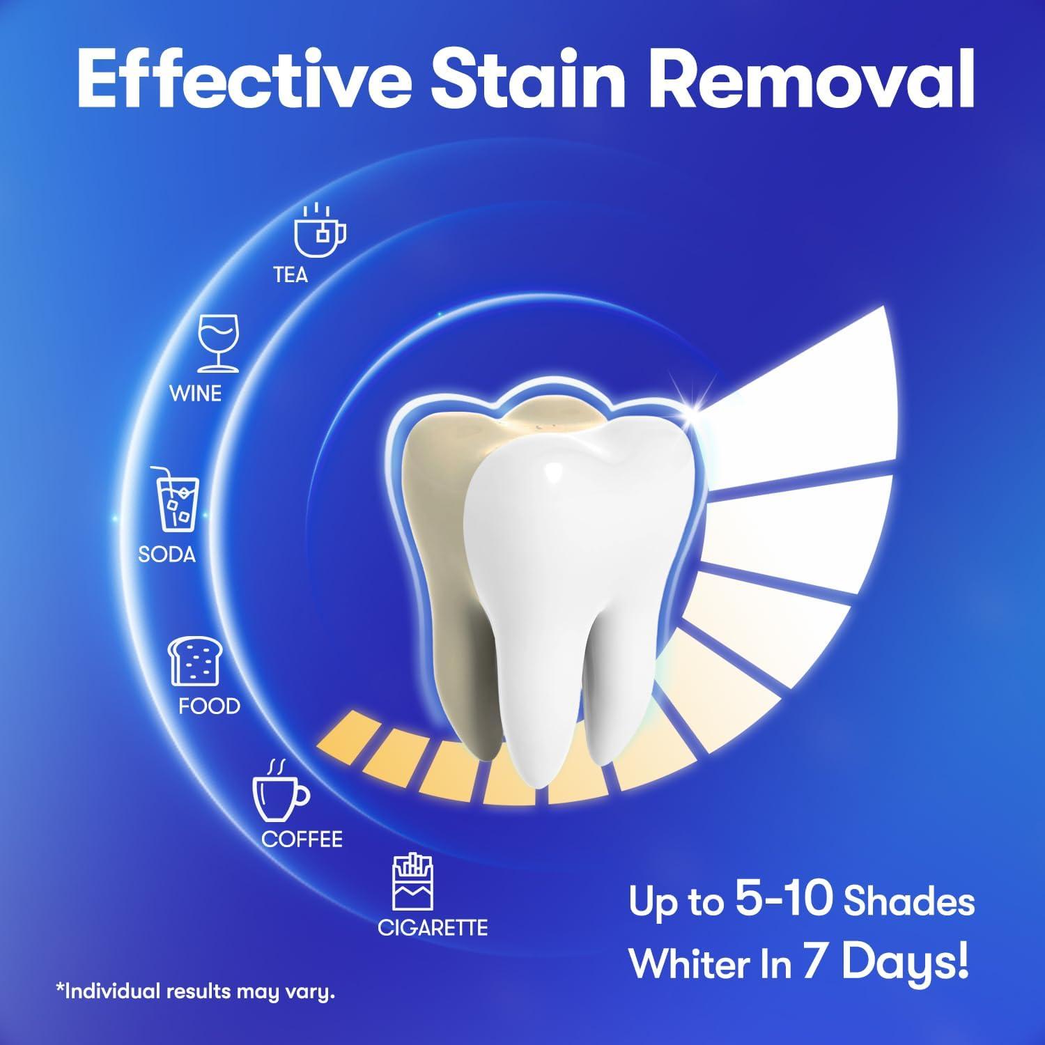 Tiras Blanqueadoras MySmile - Blanqueamiento Dental Sin Sensibilidad - Kit de 7 Tratamientos