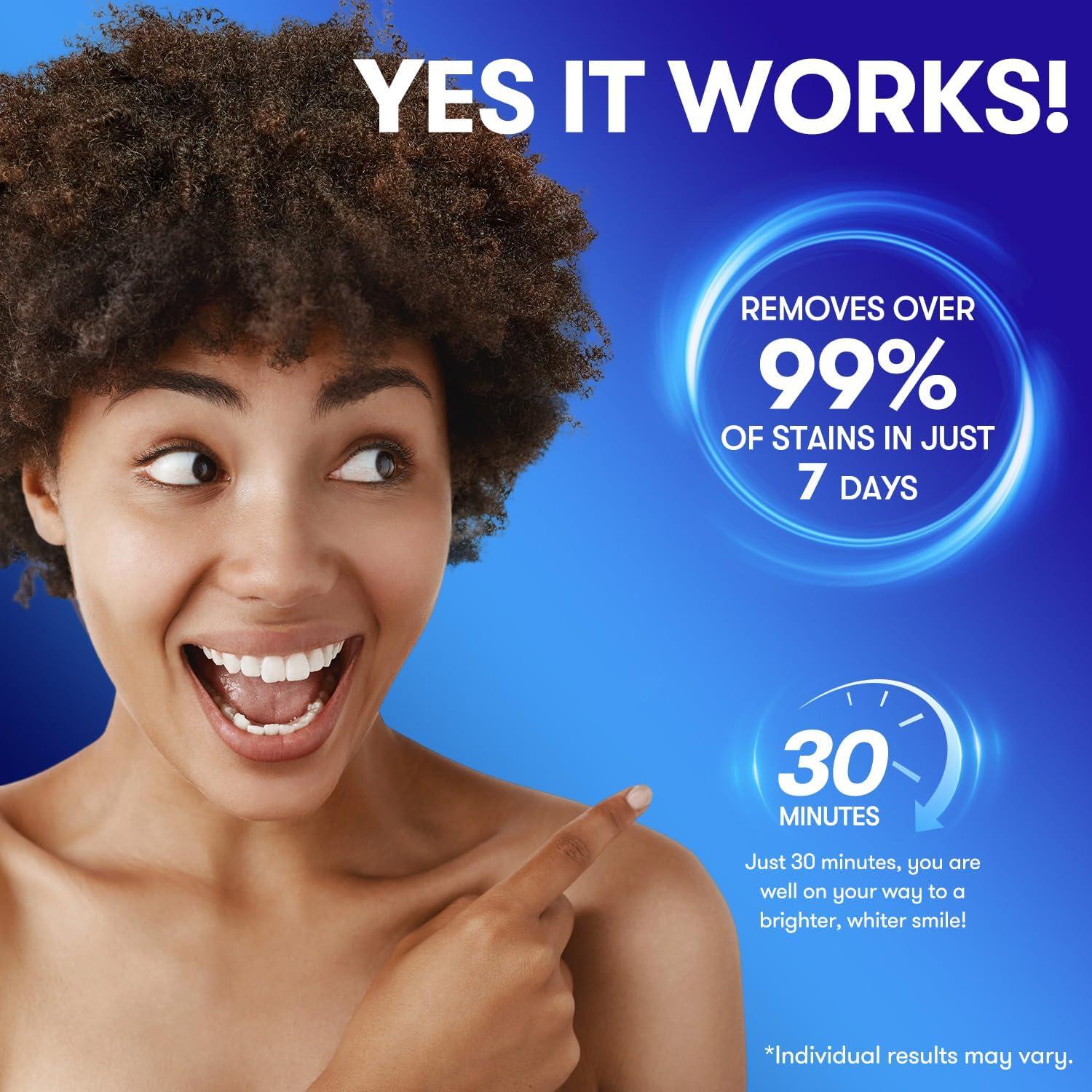 Tiras Blanqueadoras MySmile - 28 Tratamientos Sin Sensibilidad