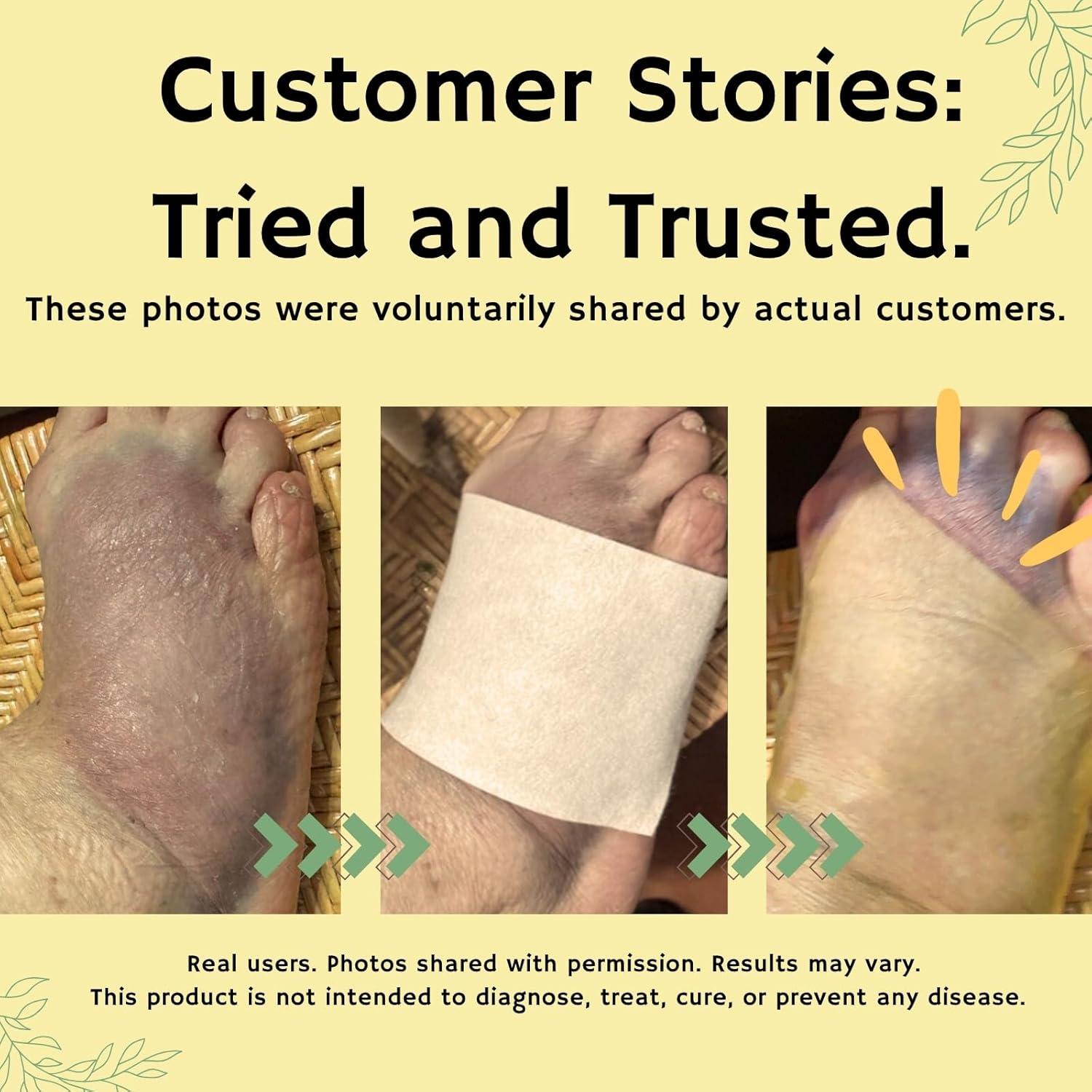 Parches Tópicos de Cúrcuma y Curcumina Amor - 6 Parches 13x9cm