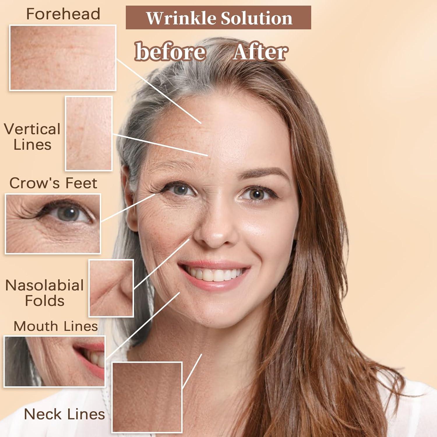 Cinta Facial Levantadora WXYISIVEN - 3 Rollos 1cm, 2cm, 2.5cm x 5m