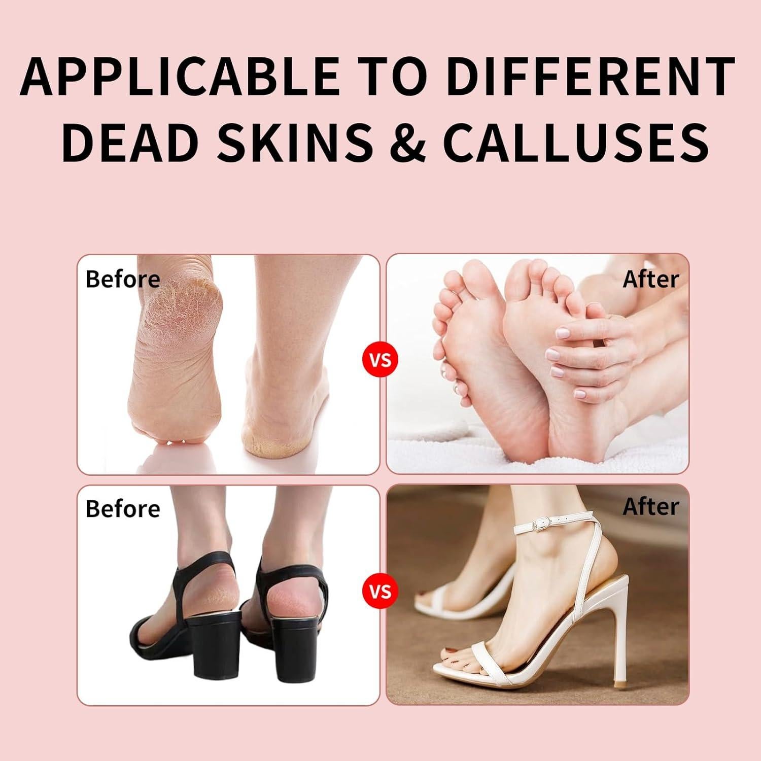 Removedor Eléctrico de Callos Turoco M-02 con 60 Discos