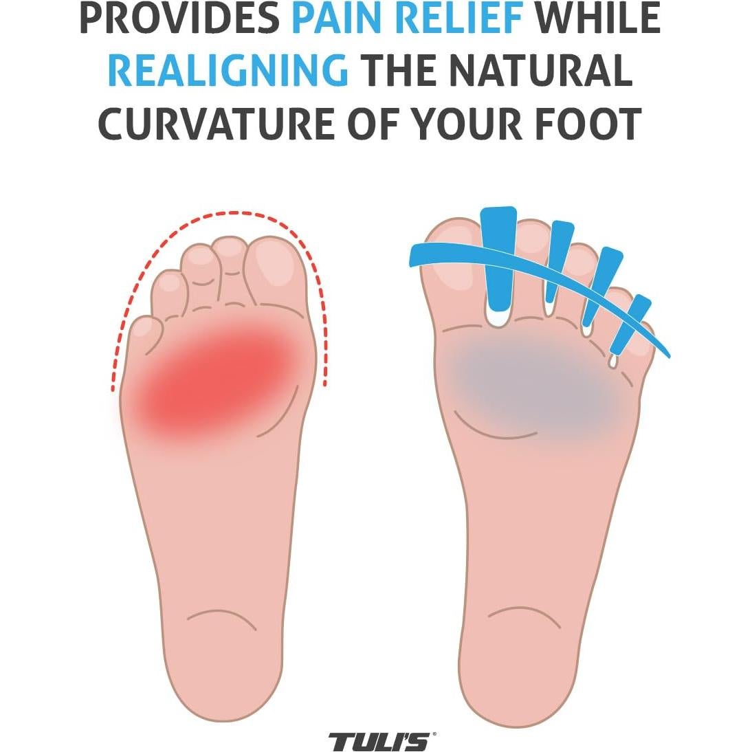 Separadores de Dedos Ajustables Tuli's SoftMoves - Alivio Juanetes y Fascitis Plantar