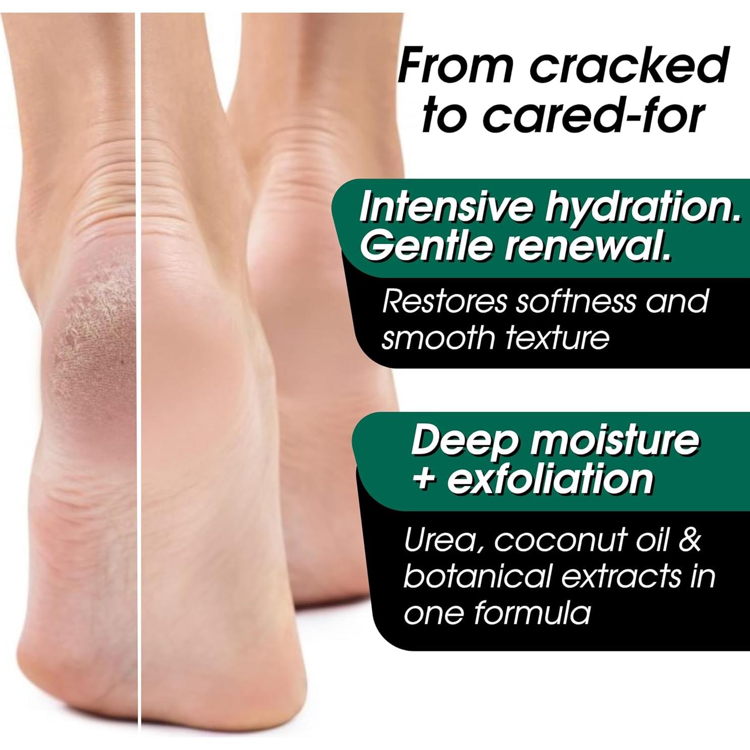 Crema de Urea 40% FAMILIA MARAVILLOSA 118ml Hidratante Pies