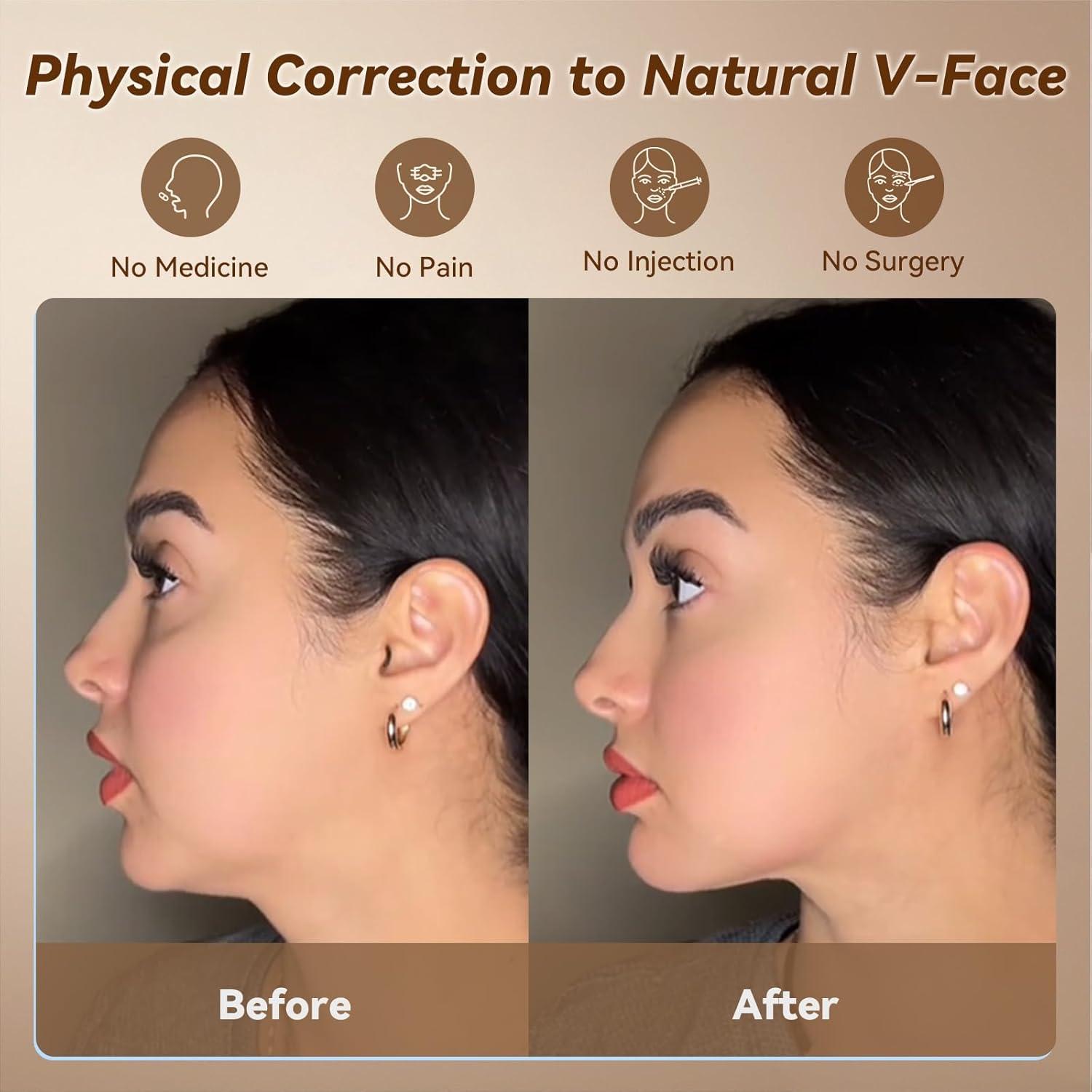 Mascarilla Chin Up JUSRON V-Line Silicona Suave 23-27 cm Azul