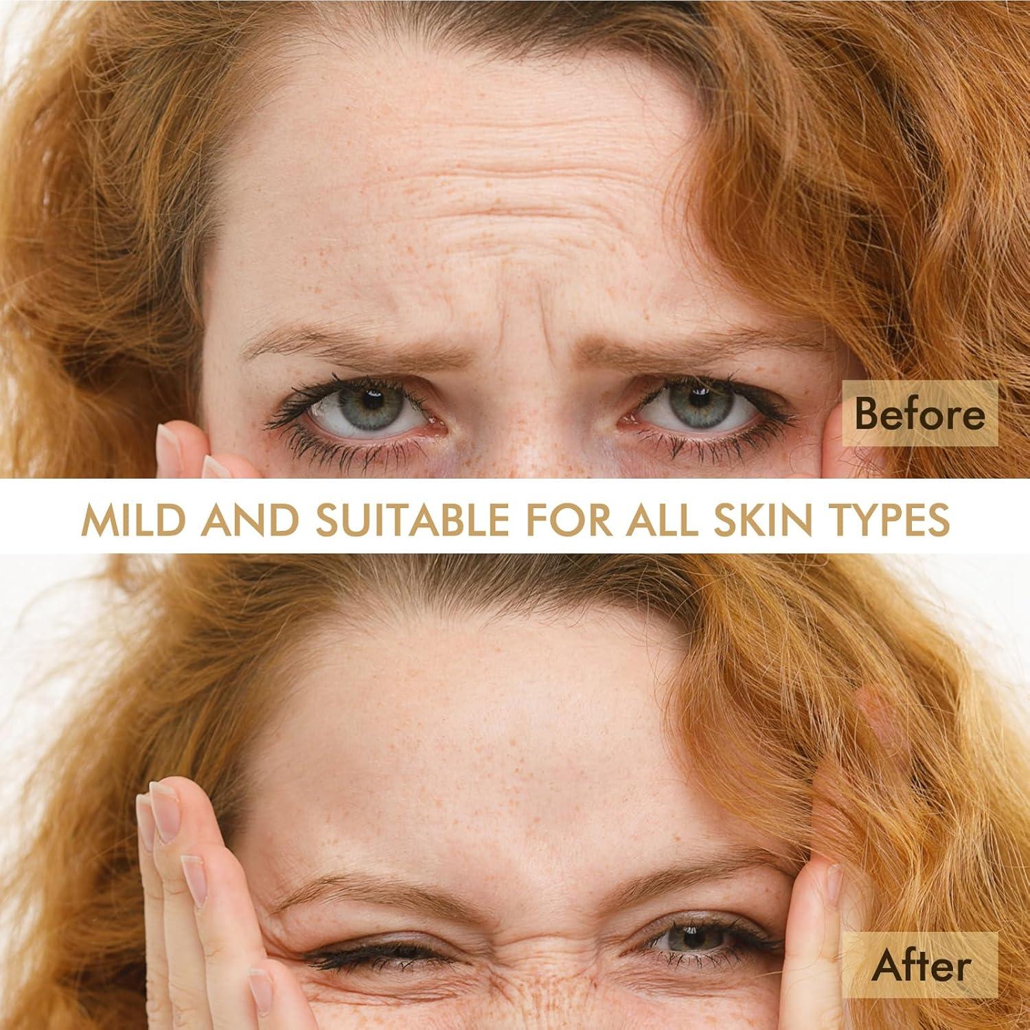 Parches Antienvejecimiento AUSLKA 24PCS con Aloe y Colágeno