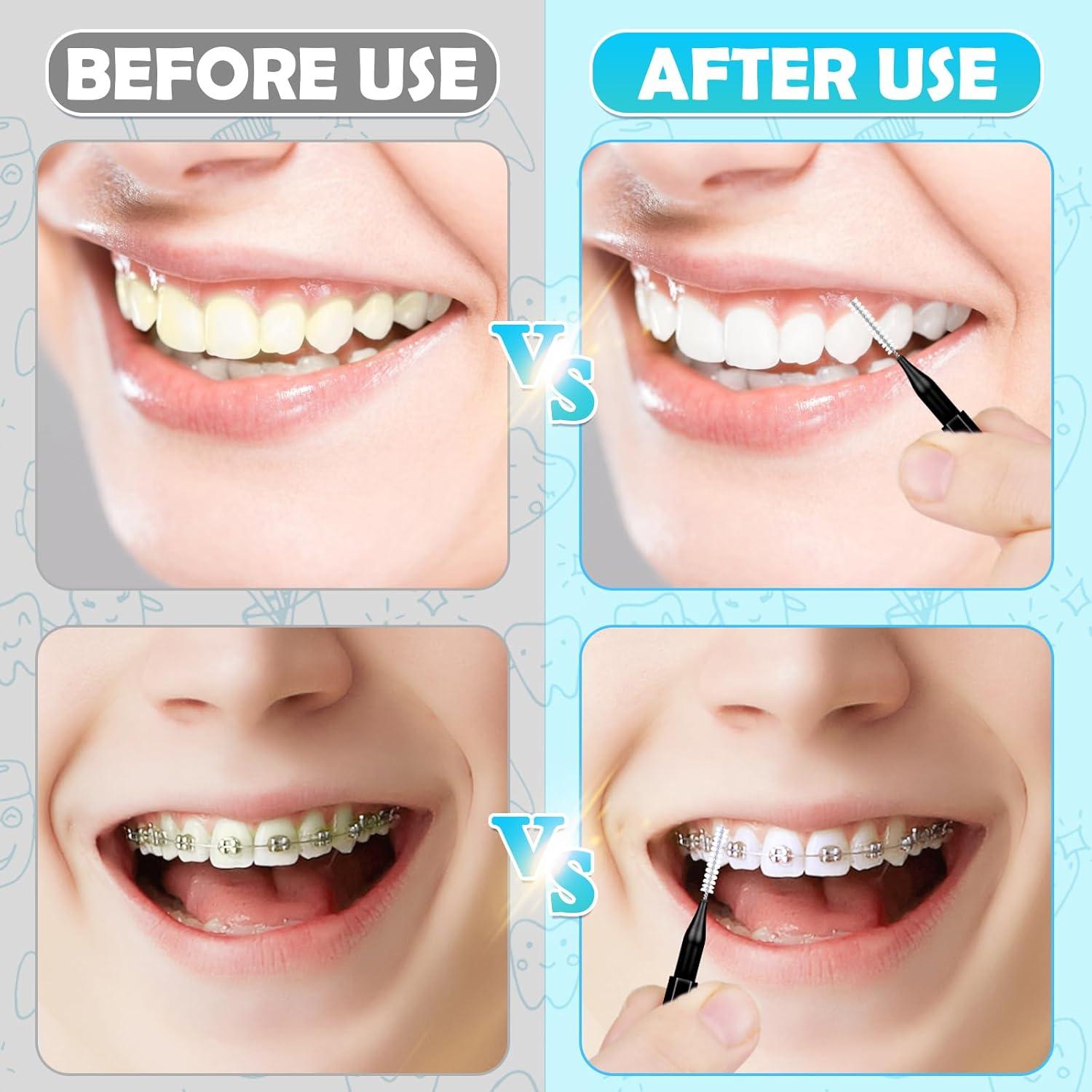 120 Cepillos Interdentales MAPVOLUT para Cuidado Oral Negro