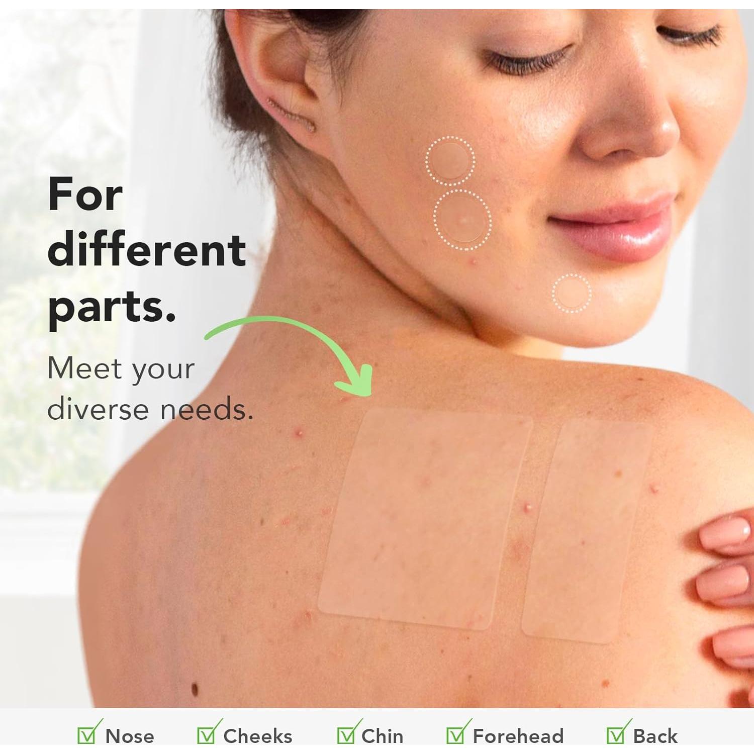 Parches para Granitos ZATKTK - 188 Parches Hidrocoloide