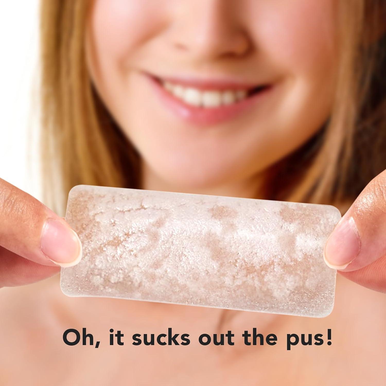 Parches para Granitos ZATKTK - 188 Parches Hidrocoloide