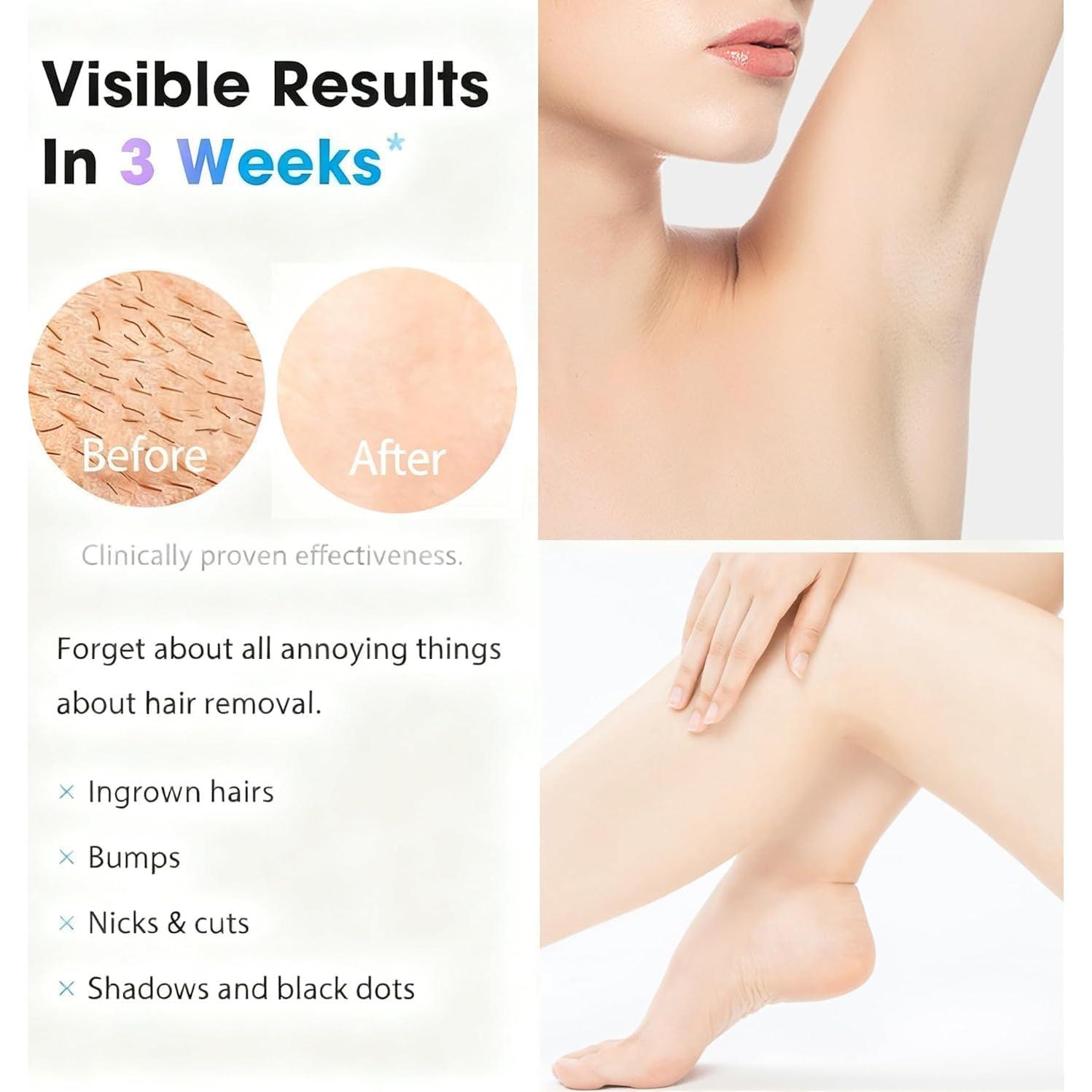 Depiladora Láser IPL Gransumr - Eliminación Permanente de Vello