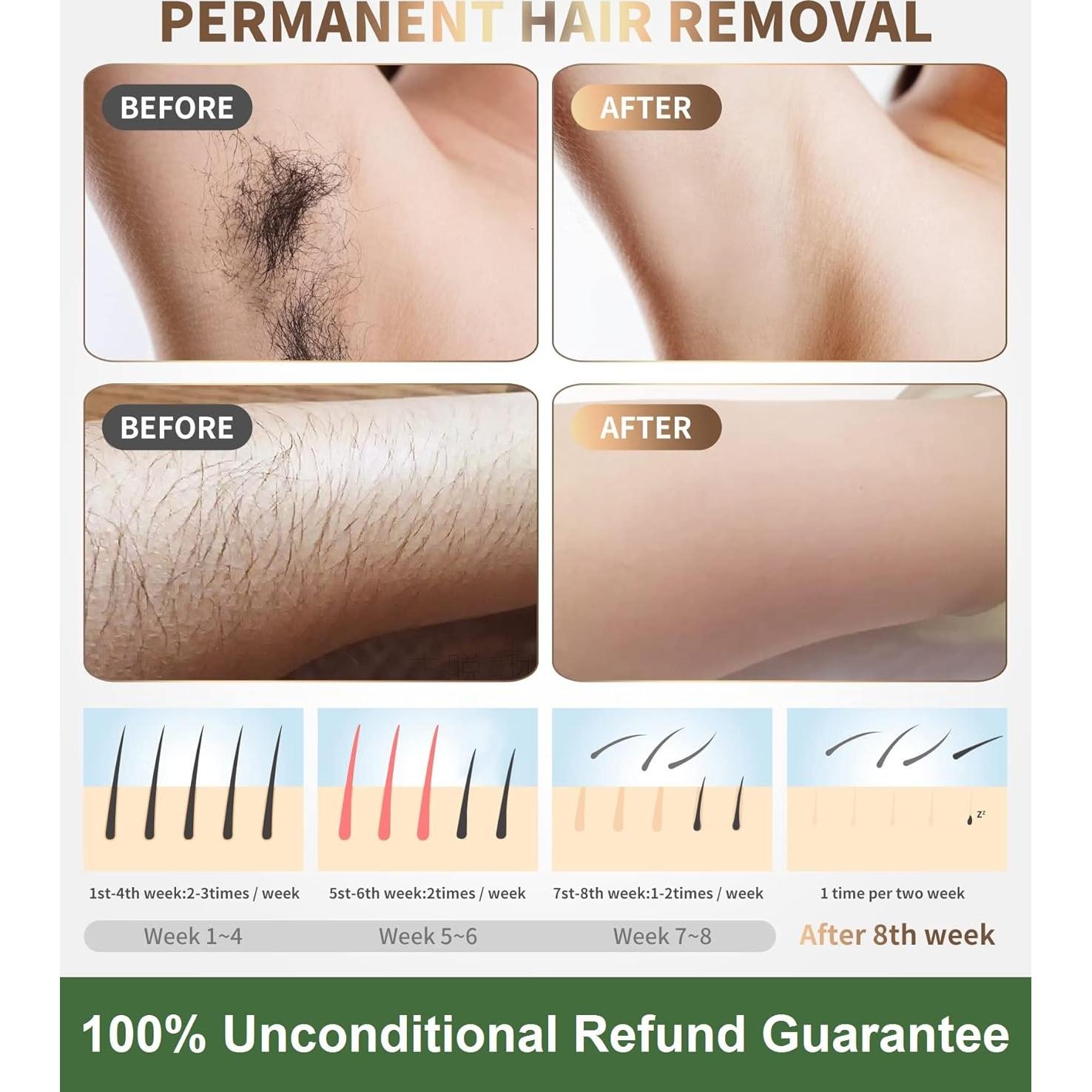 Depiladora Láser IPL Gransumr - Eliminación Permanente de Vello