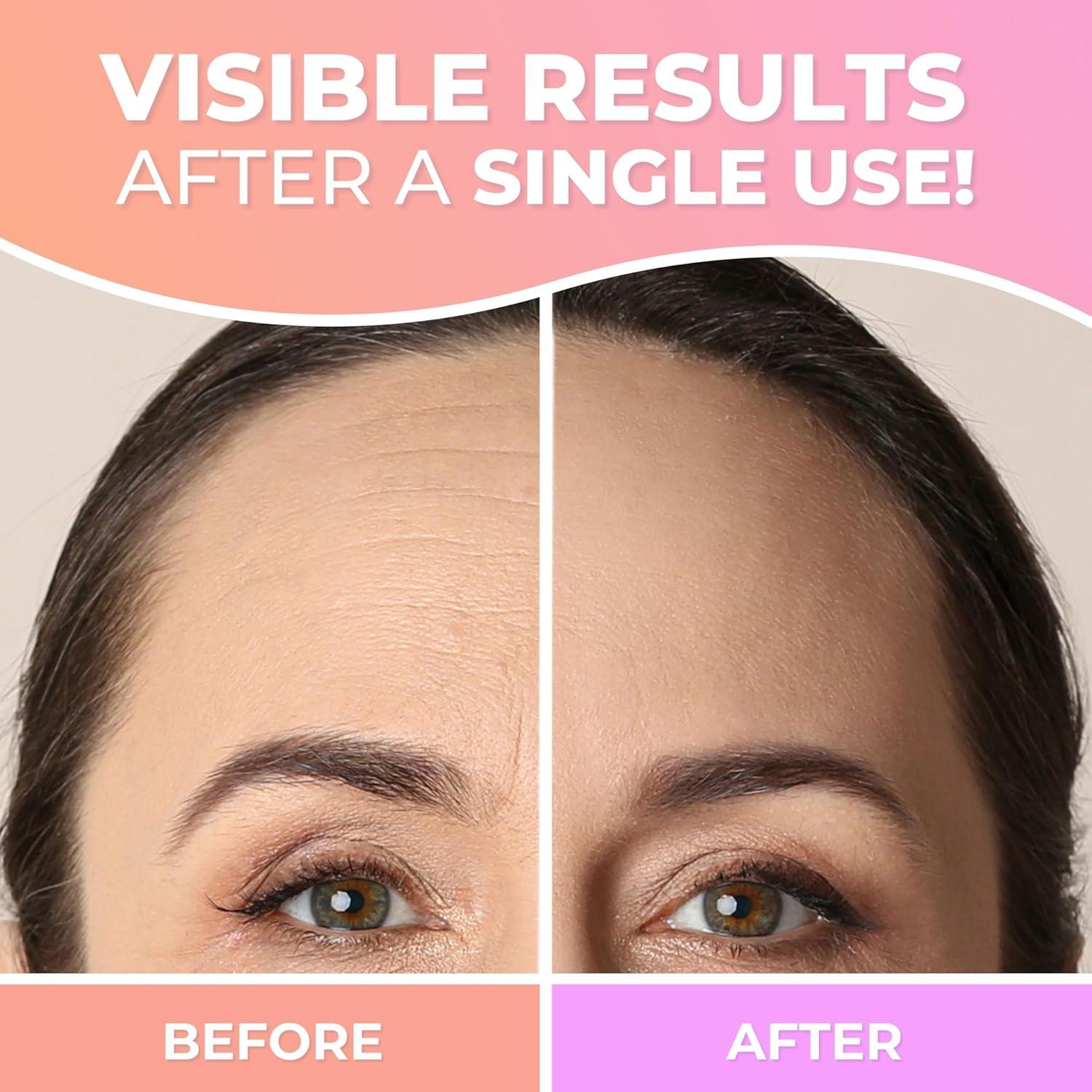 Parches de Silicona Antiarrugas Cleverfy - 2 Unidades Reutilizables