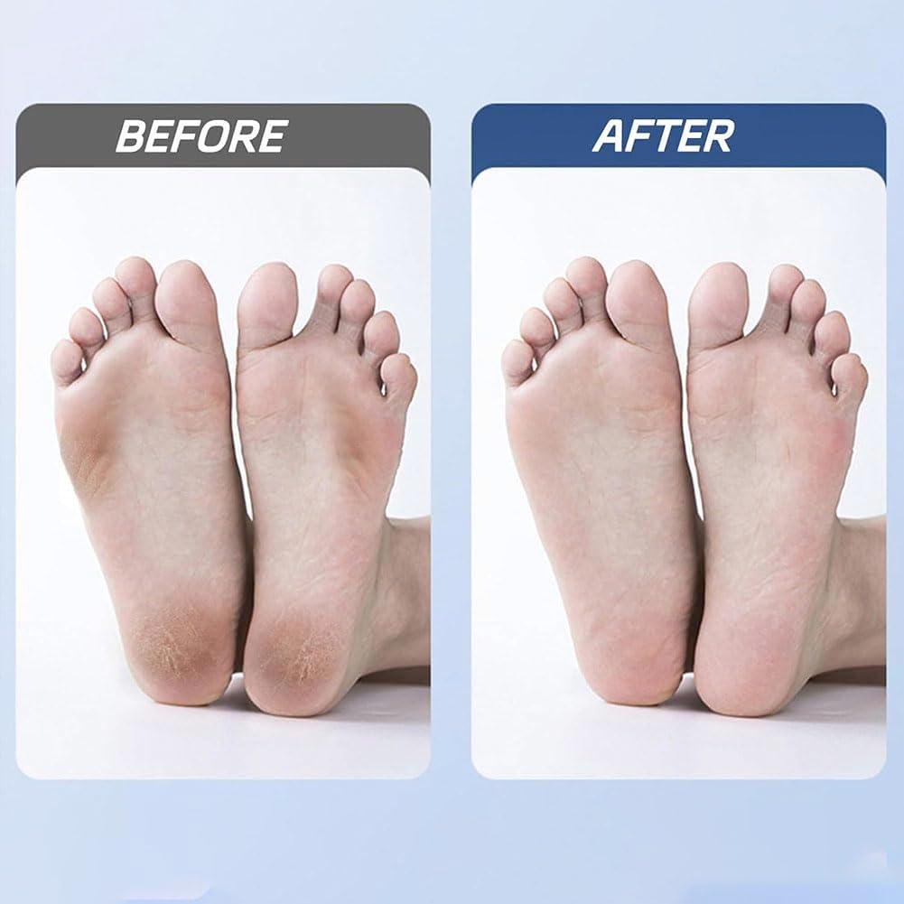 Morrat Molinillo de Pies Eléctrico Inalámbrico 2 Velocidades