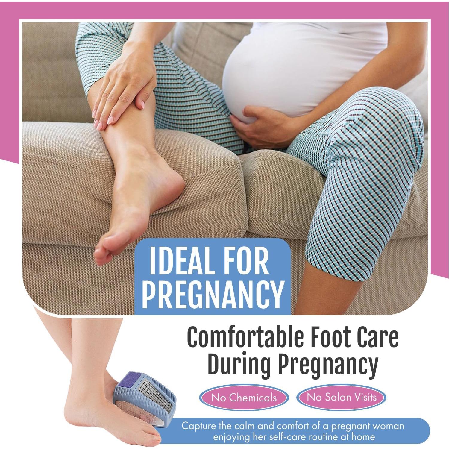 Exfoliador de Pies 3 en 1 Wonex - Removedor de Callos Gris