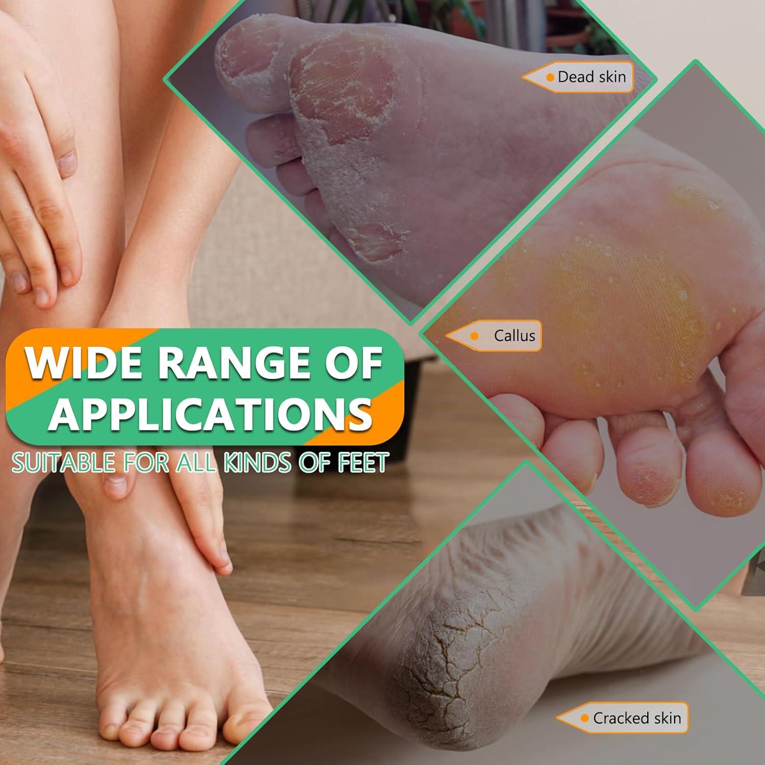 Lima de Pedicura Profesional ALOCKMA - Acero Inoxidable, Mango Ergonómico