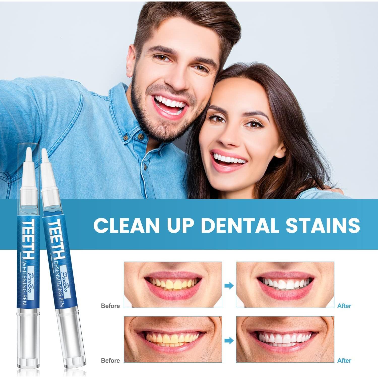 Bolígrafo Blanqueador de Dientes Garage Sale Pup - 5 Unidades, 70+ Usos, Sabor Menta