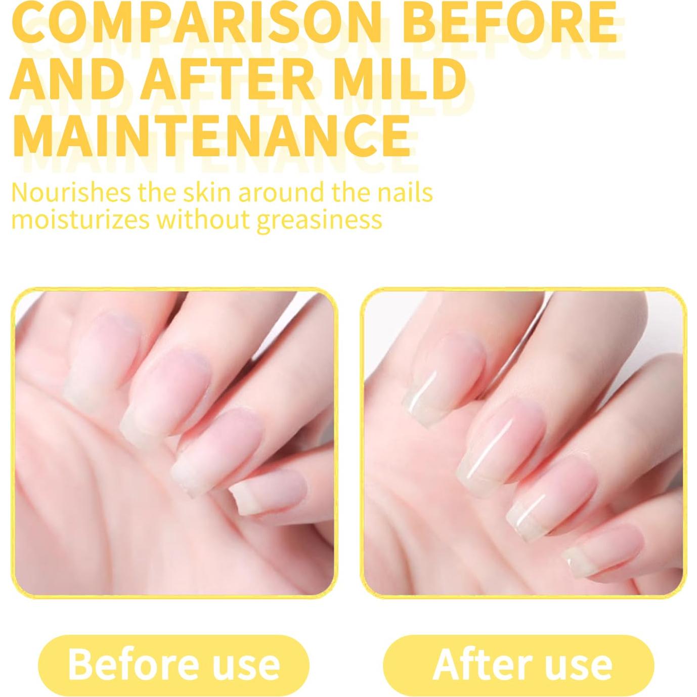 Aceite de Cutícula Finger Secret 15ml con Vitamina E y Aloe