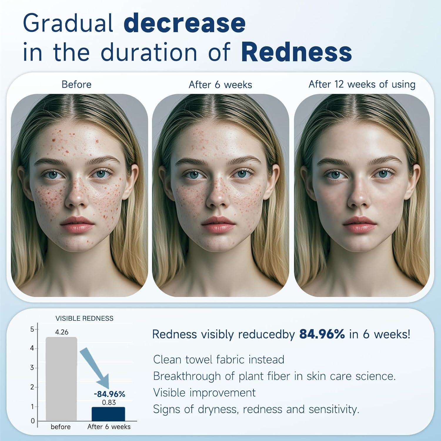 Toallas Faciales Desechables Biodegradables HMTM 45 Unidades