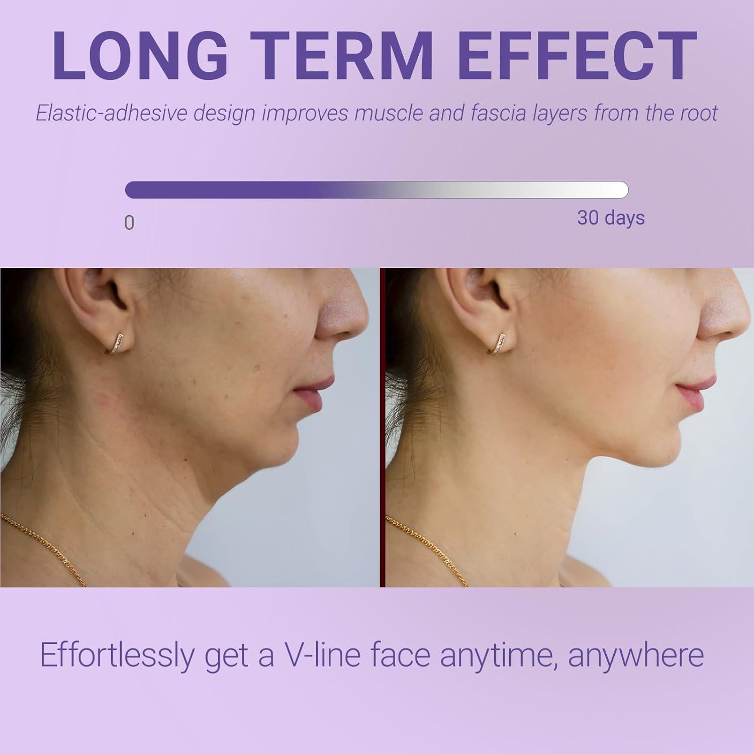 Correa para Barbilla para Dormir Sfuchin - Reductor Doble Barbilla