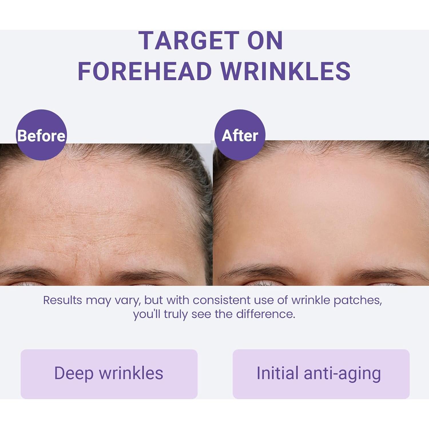 Parche Antienvejecimiento Sfuchin para Arrugas en la Frente 20 Pcs