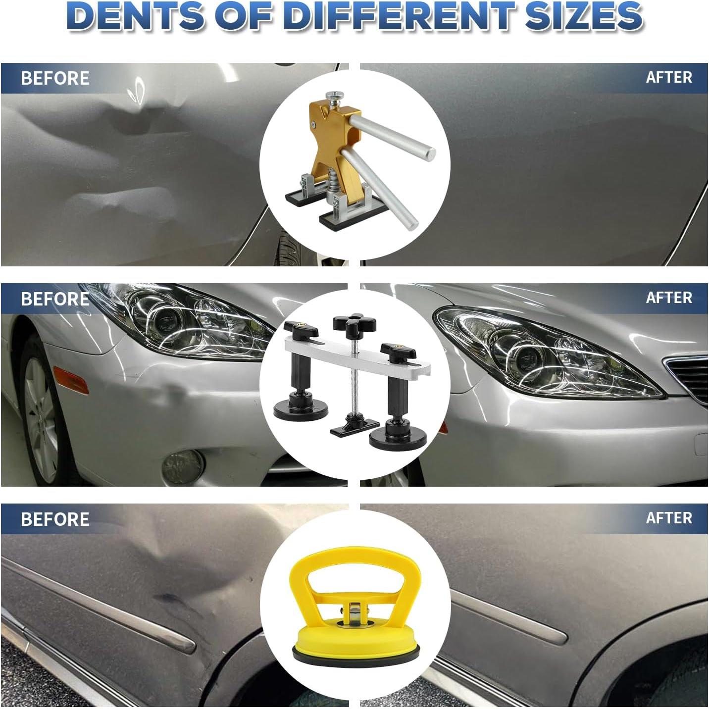 Kit de Reparación de Abolladuras ROADGIVE 75PCS Ergonómico