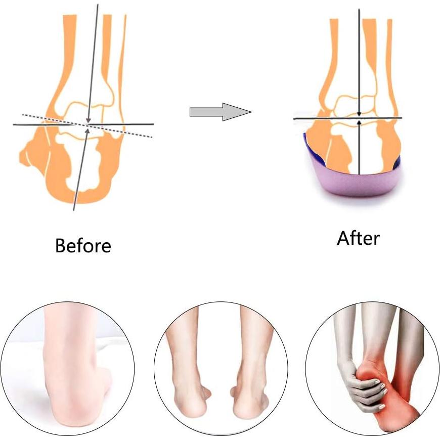Plantillas ortopédicas 3/4 PCSsole para fascitis plantar y pies planos