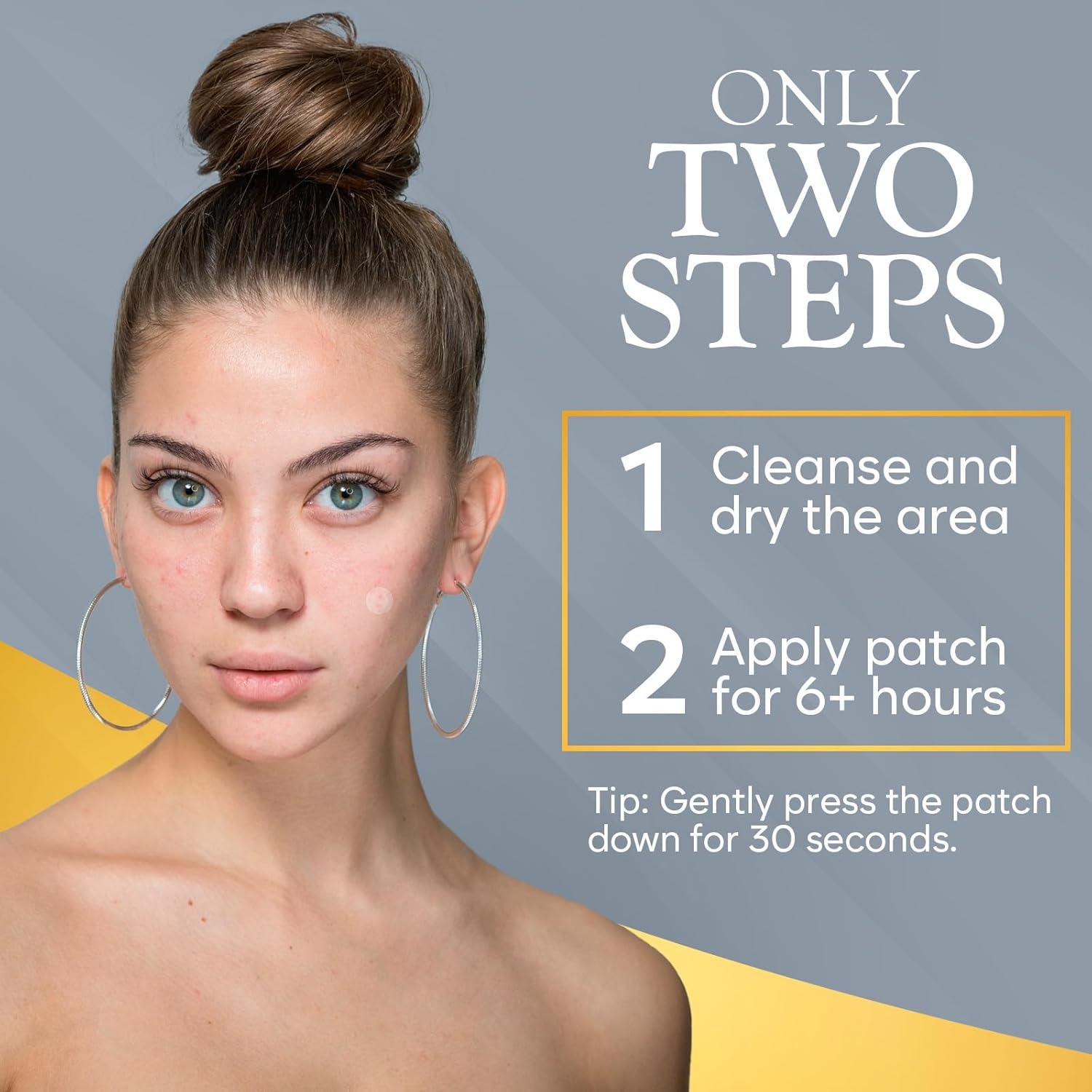 Parche Microdart para Acné Quístico Bloomora - 12 Unidades