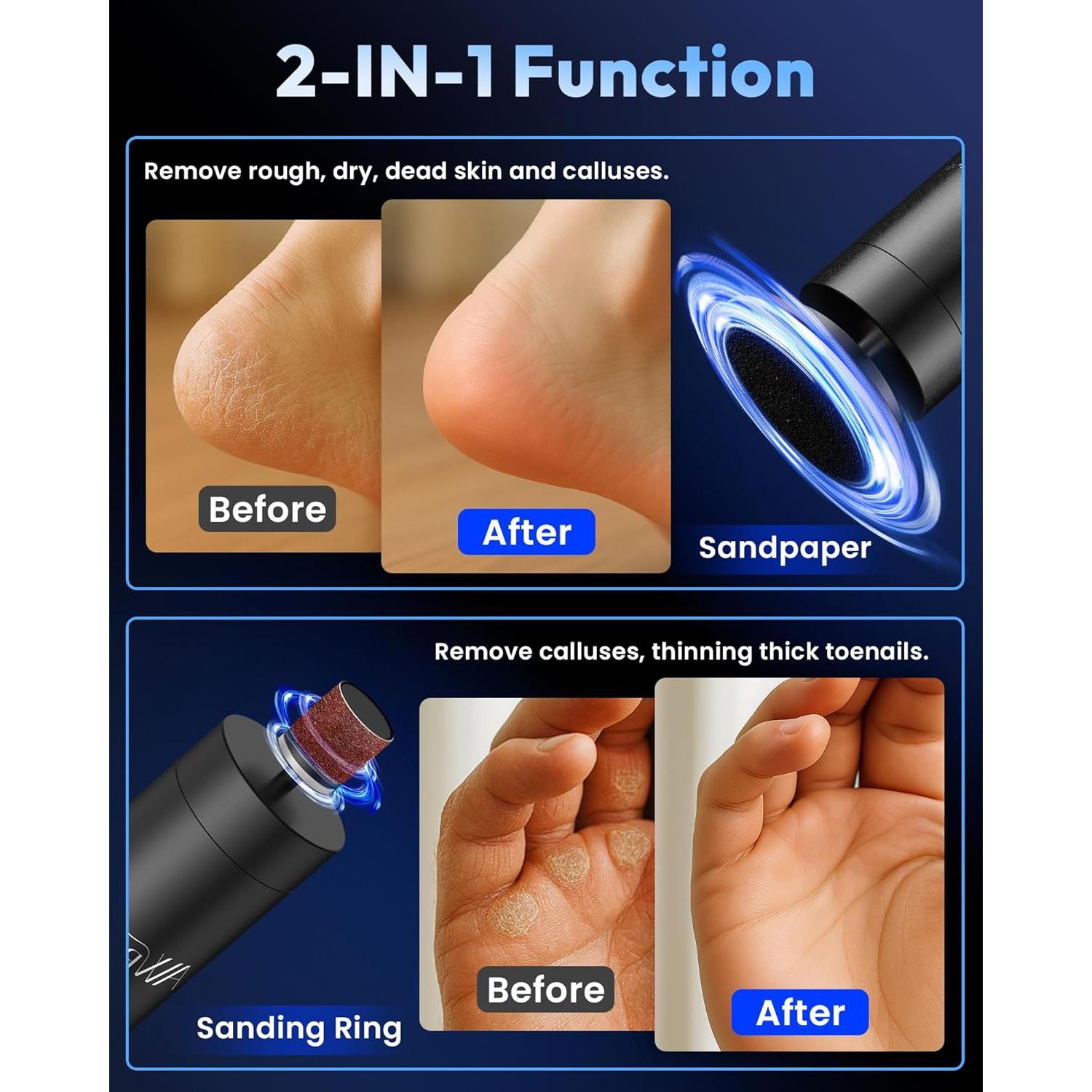 Removedor de Callos Eléctrico AWROSE Inalámbrico 2600mAh