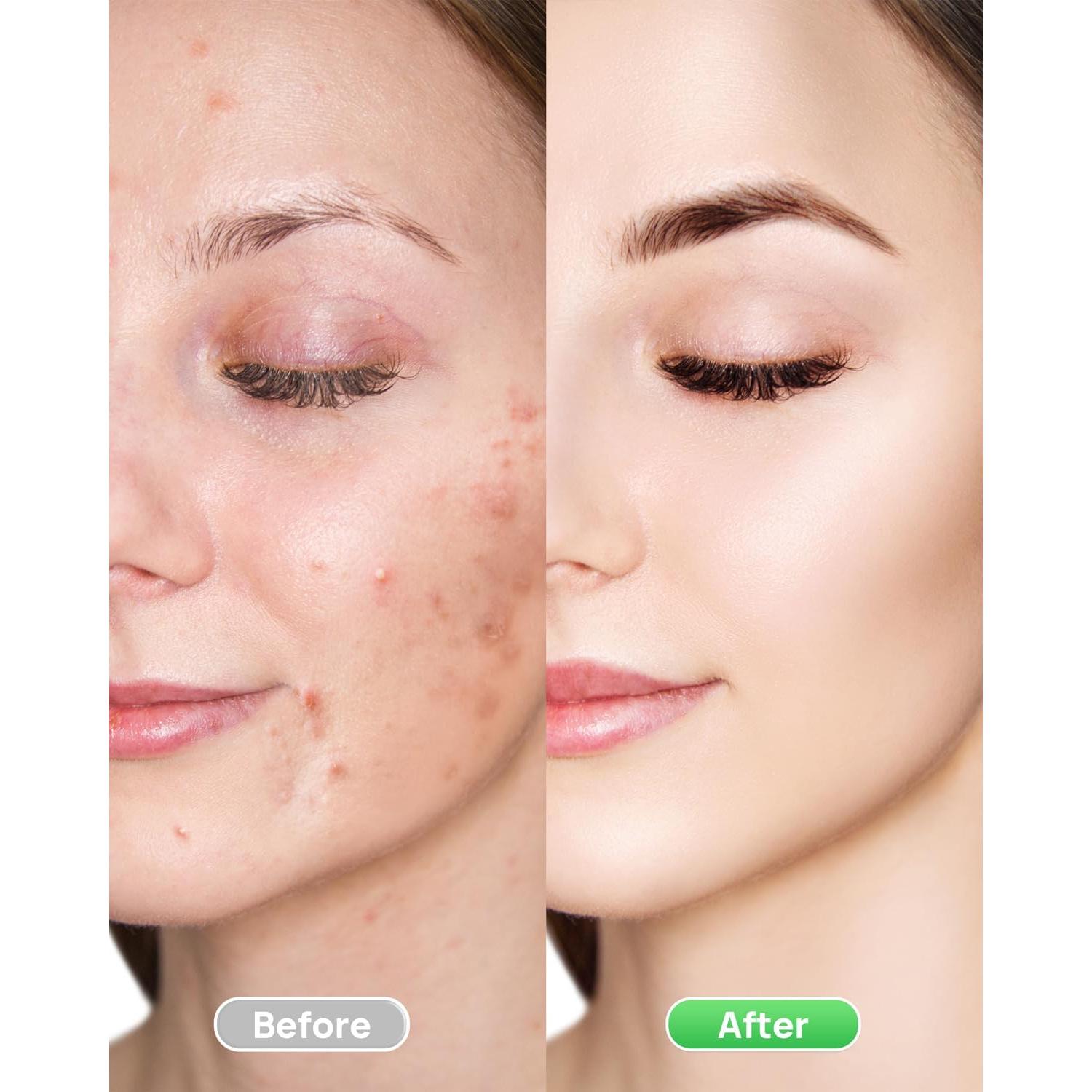 Corrector de Color Verde RTETETOK para Enrojecimiento Facial 40g