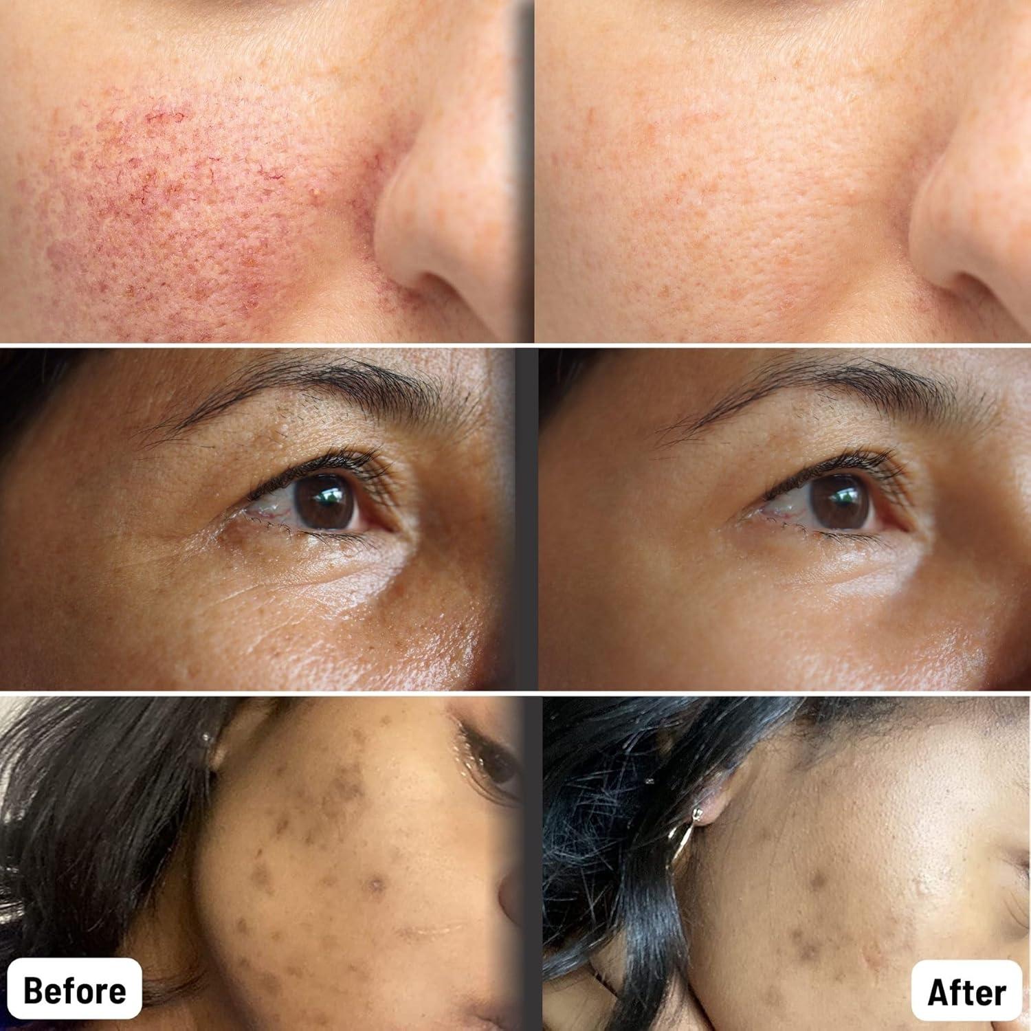 Máscaras de Hoja Orgánica ORGAID - Hidratante Antienvejecimiento, 4 Unidades