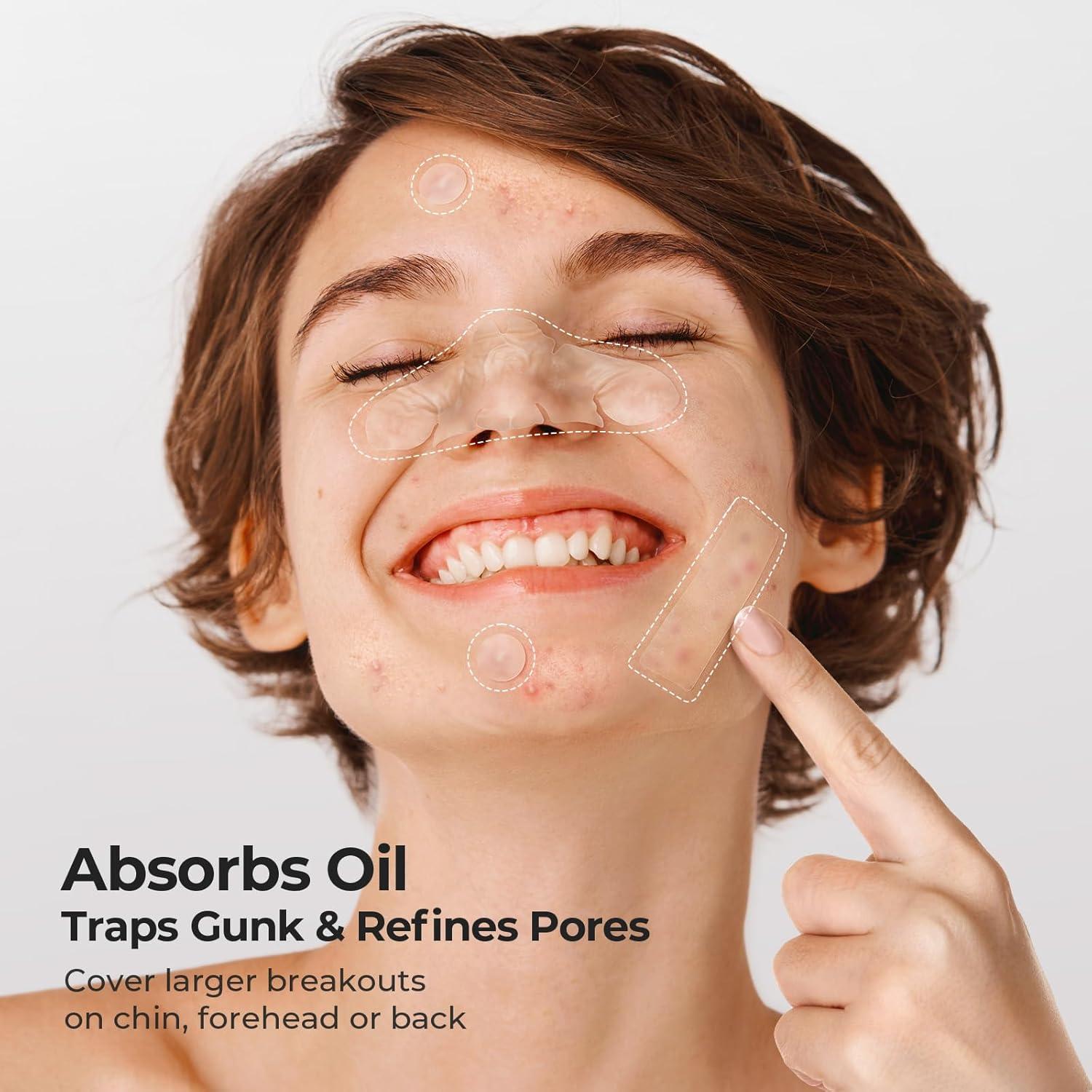 Parches Hidrocoloides TKTK para Nariz - 112 Parches 91x48mm