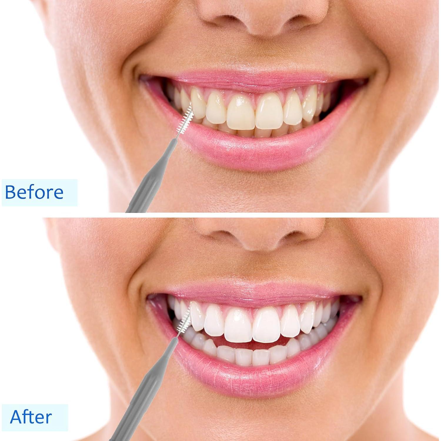 100 Piezas Cepillos Interdentales Patelai Higiene Oral Gris