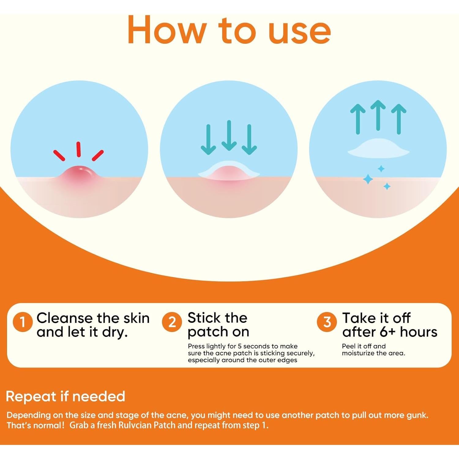 Parche para Acné Rulvcian - 54 Unidades, Microdart y Ácido Salicílico