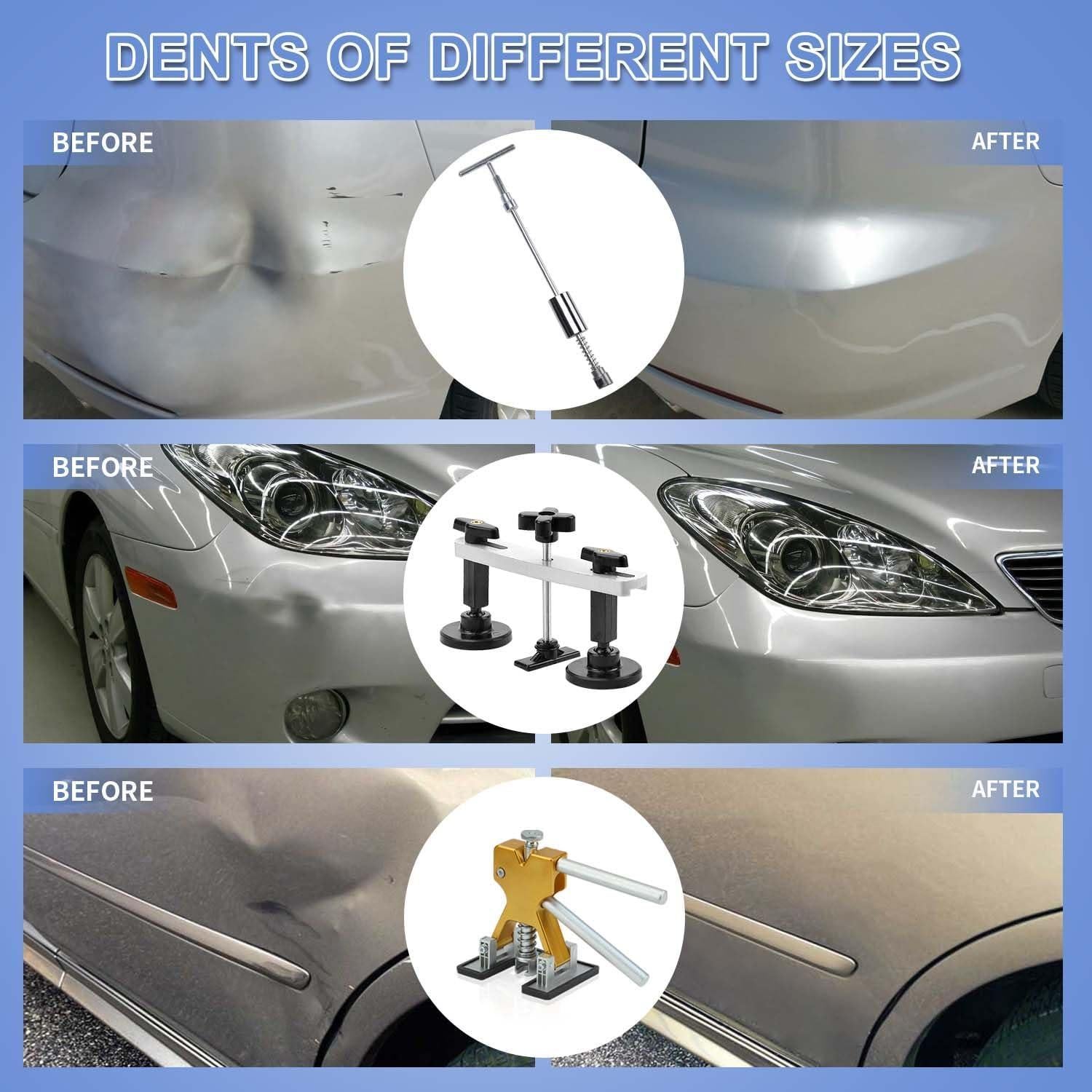 Kit de Eliminación de Abolladuras ROADGIVE 108PCS Herramientas