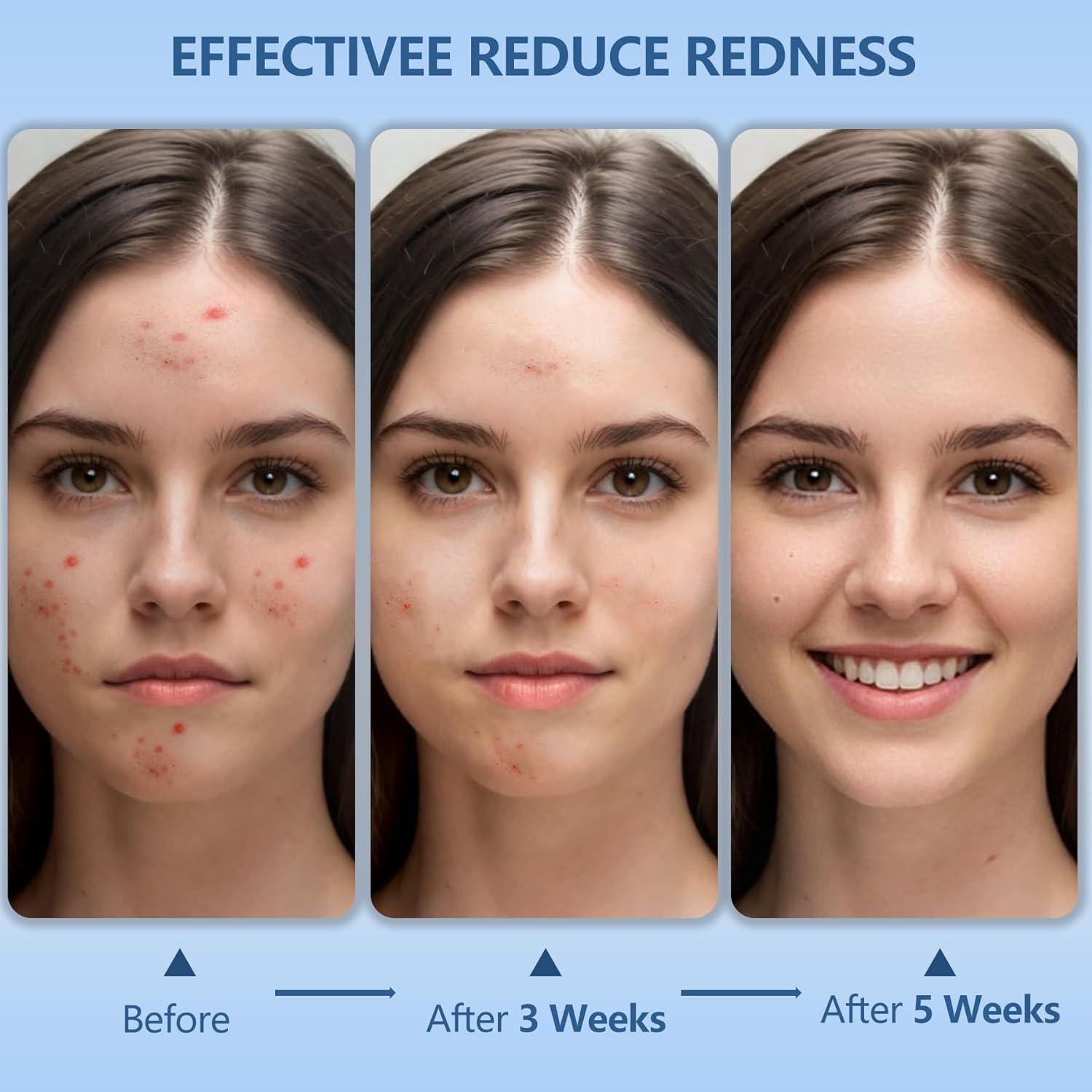 Toallas Faciales Desechables Dorahoney 30.48x30.48 cm 20 Pzas