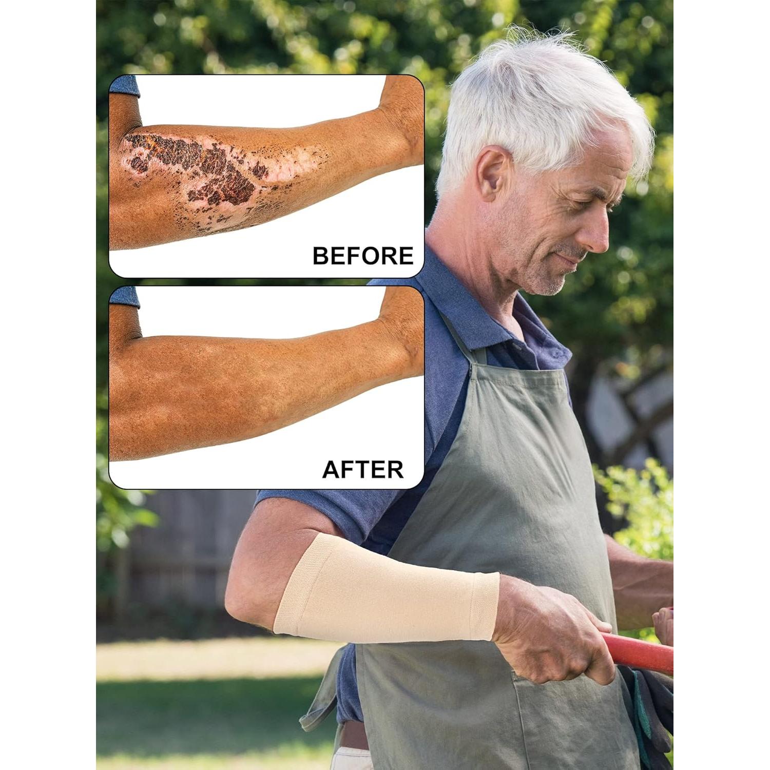 Janmercy 9 Pares Protectores de Brazo para Piel Delgada Beige