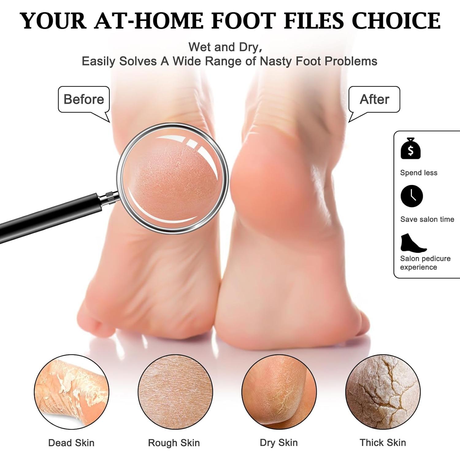 Lima de Pies HOFASON 10 Piezas Exfoliador Profesional Doble Cara