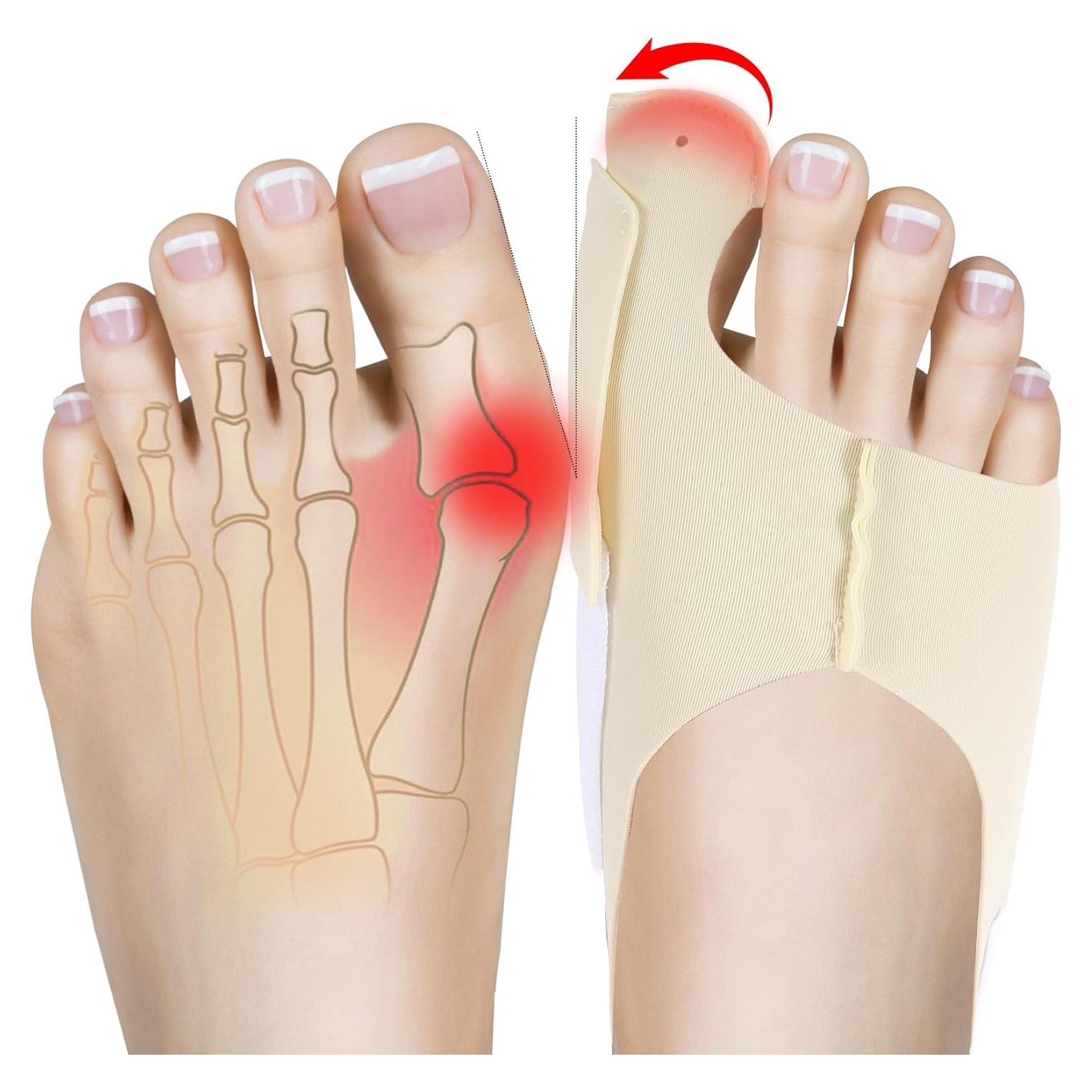 Corrector de Hallux Valgus NOWFRESH 2 Piezas Ajustable - Alivio para Juanetes